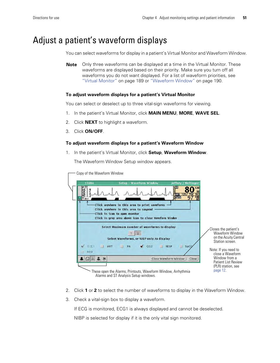 Adjust a patient’s waveform displays | Welch Allyn Acuity and Mobile Acuity LT Central Monitoring Systems - User Manual User Manual | Page 55 / 214
