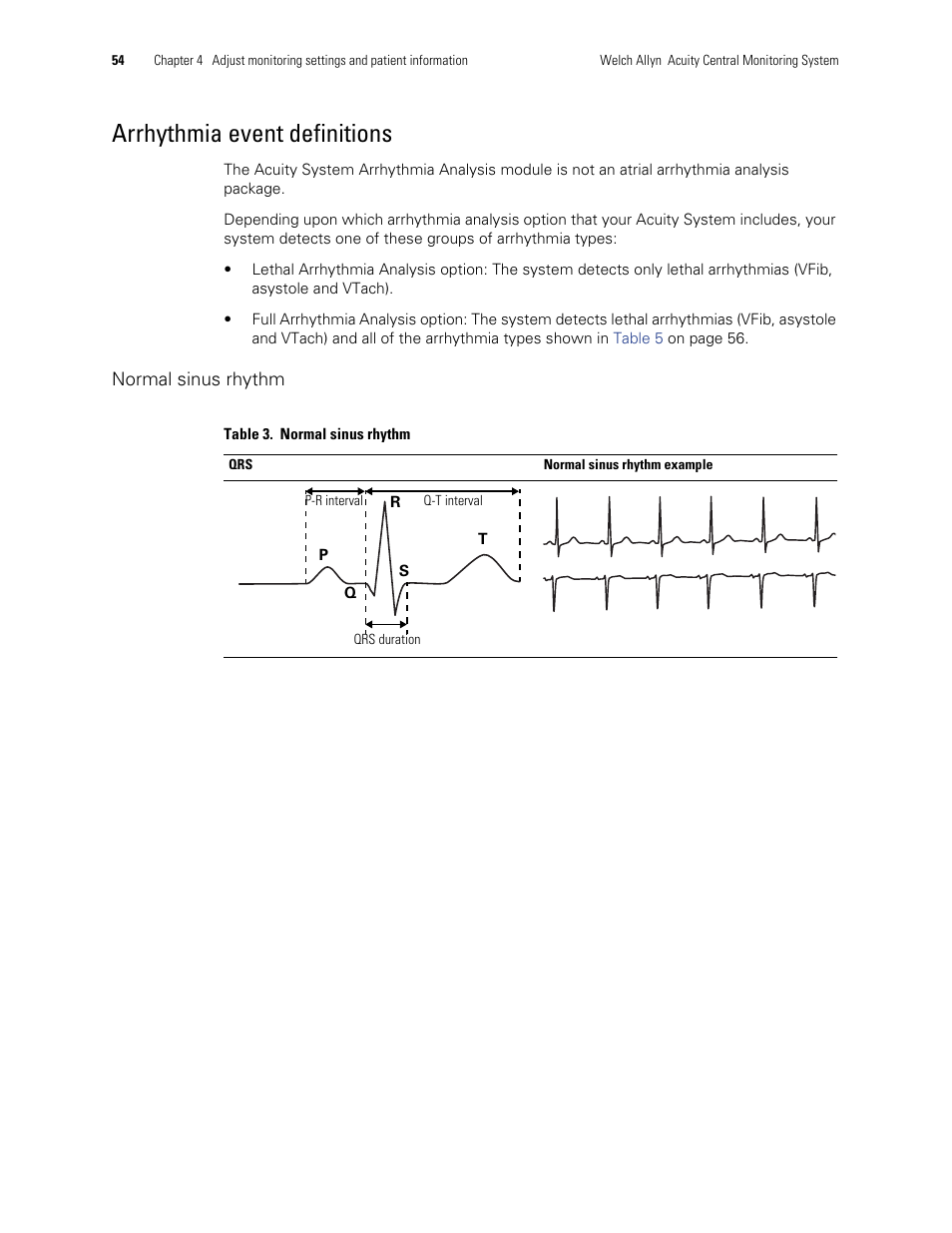 Arrhythmia event definitions | Welch Allyn Acuity and Mobile Acuity LT Central Monitoring Systems - User Manual User Manual | Page 58 / 214