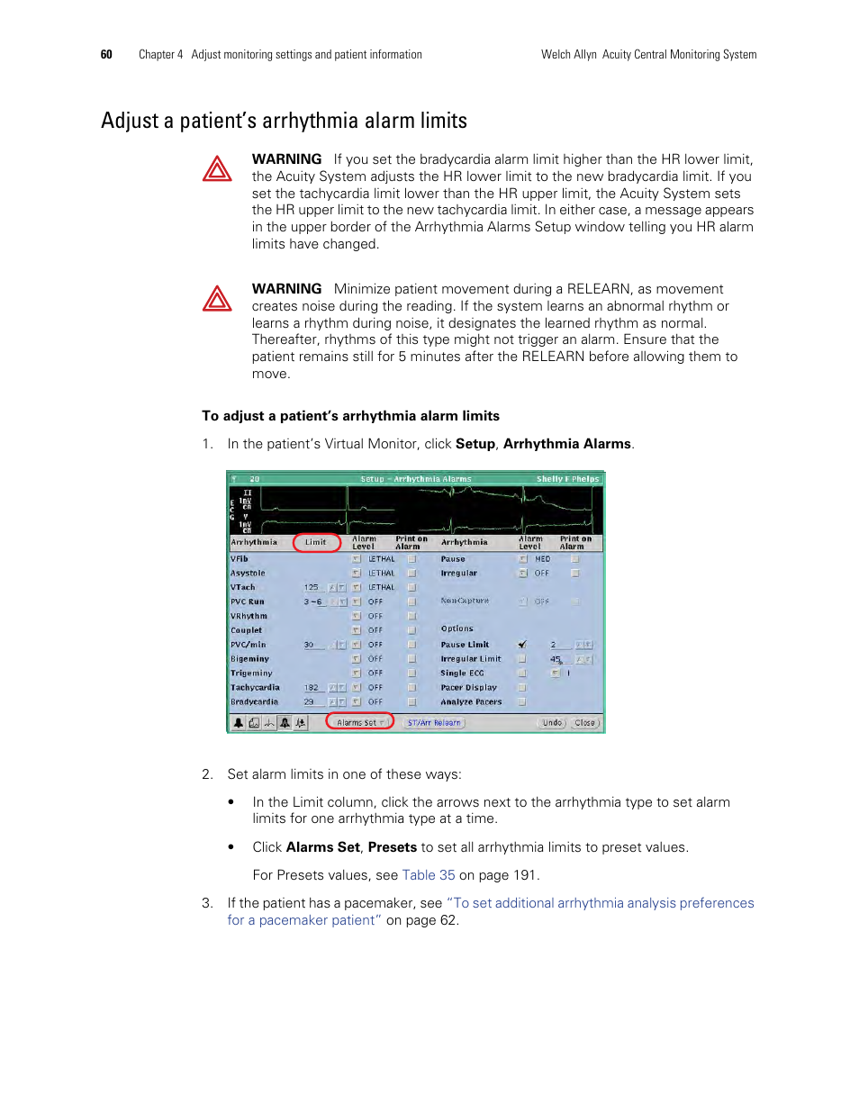 Adjust a patient’s arrhythmia alarm limits | Welch Allyn Acuity and Mobile Acuity LT Central Monitoring Systems - User Manual User Manual | Page 64 / 214