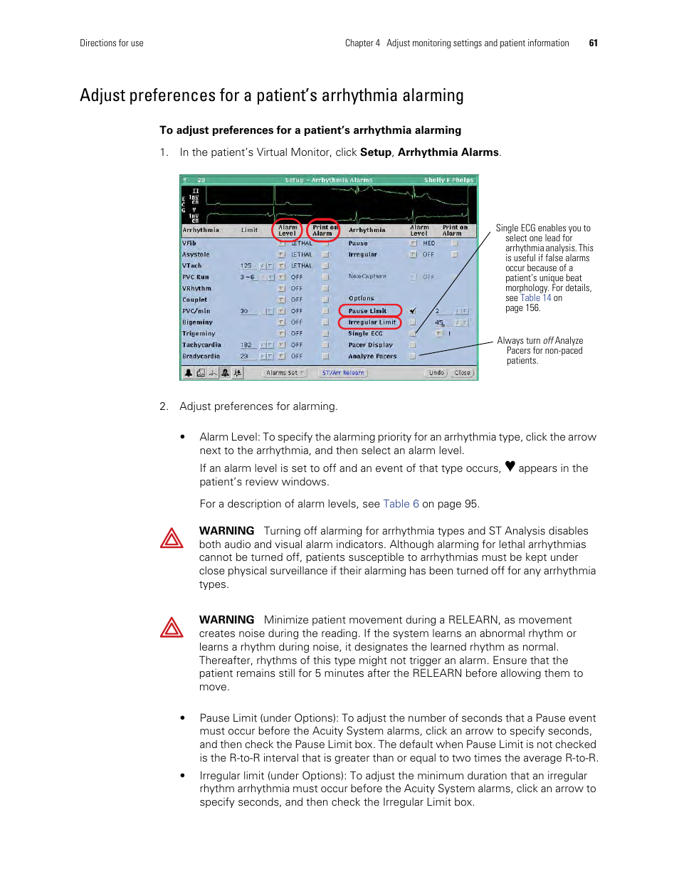Adjust preferences for a patient’s arrhythmia, Alarming | Welch Allyn Acuity and Mobile Acuity LT Central Monitoring Systems - User Manual User Manual | Page 65 / 214