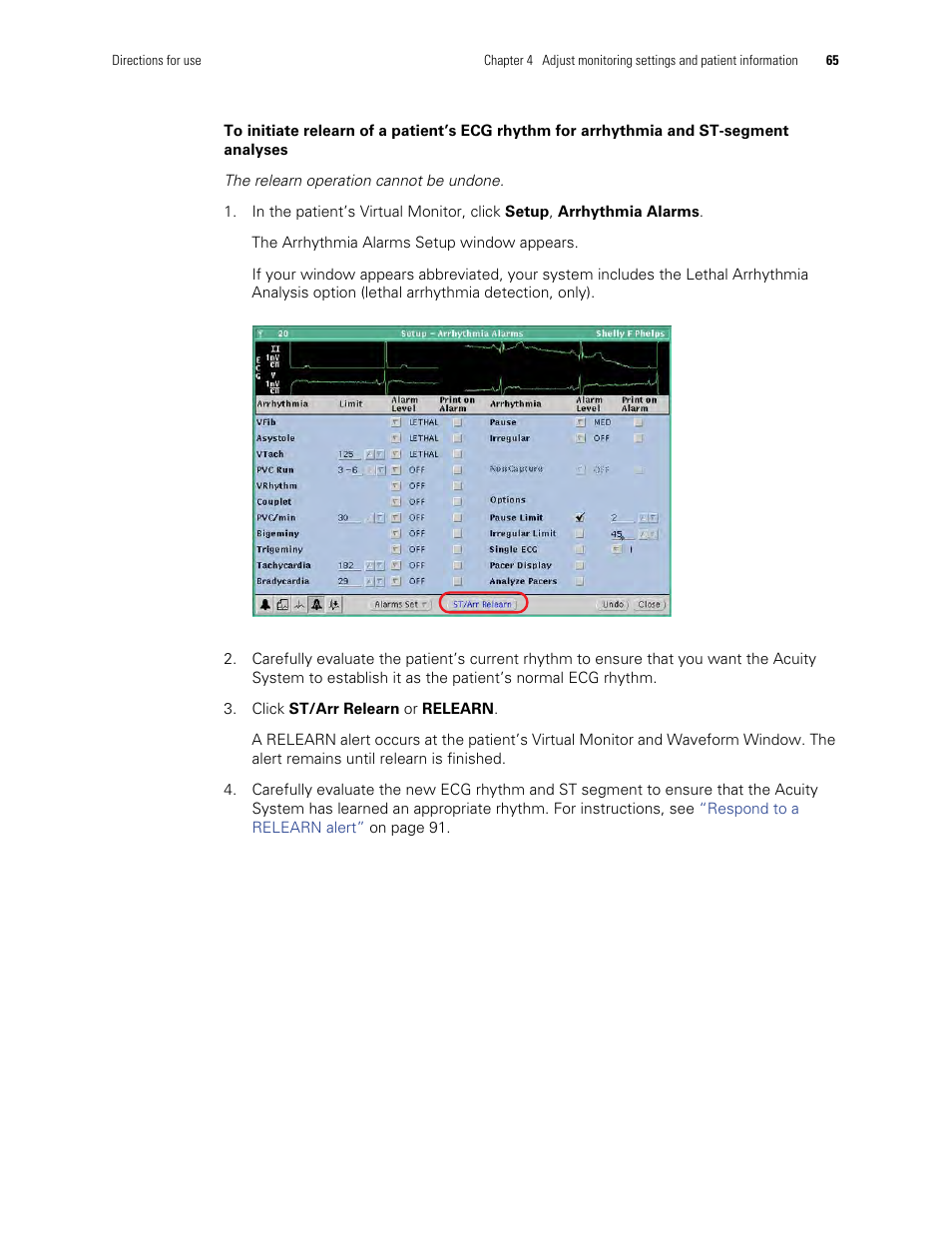 To initiate relearn of a patient’s, Ecg rhythm for arrhythmia and st-segment analyses | Welch Allyn Acuity and Mobile Acuity LT Central Monitoring Systems - User Manual User Manual | Page 69 / 214