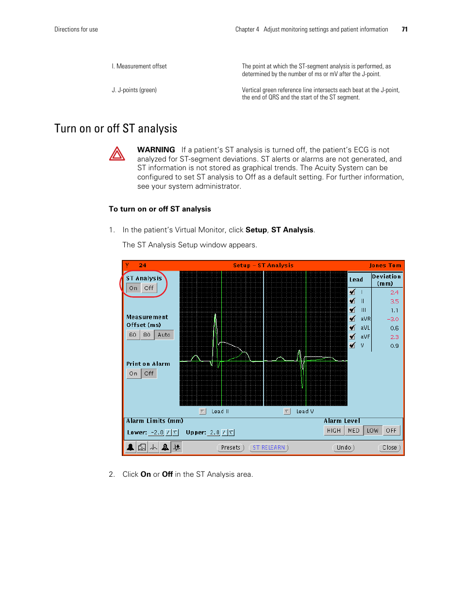 Turn on or off st analysis | Welch Allyn Acuity and Mobile Acuity LT Central Monitoring Systems - User Manual User Manual | Page 75 / 214