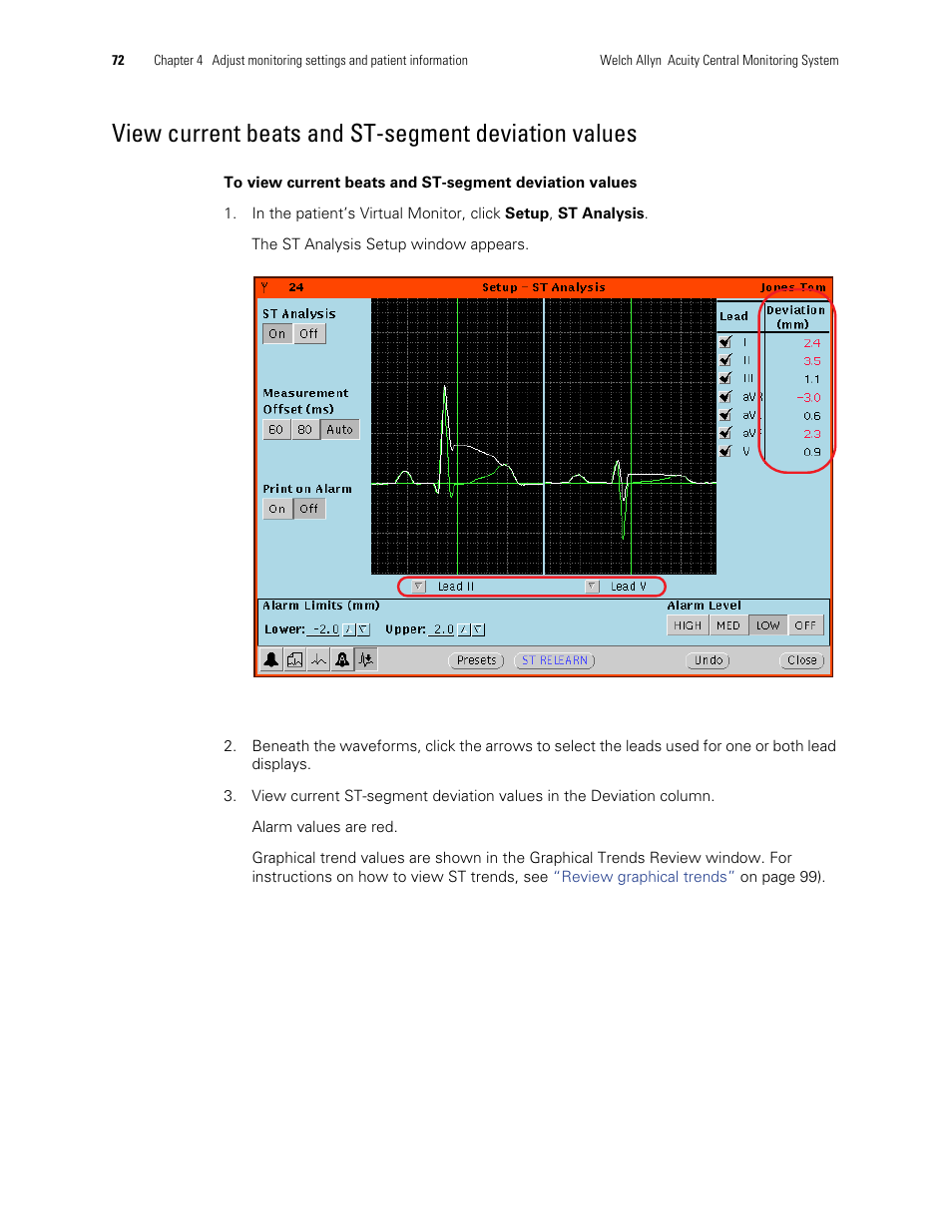 View current beats and st-segment deviation values | Welch Allyn Acuity and Mobile Acuity LT Central Monitoring Systems - User Manual User Manual | Page 76 / 214