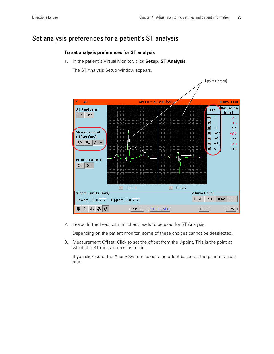 Welch Allyn Acuity and Mobile Acuity LT Central Monitoring Systems - User Manual User Manual | Page 77 / 214
