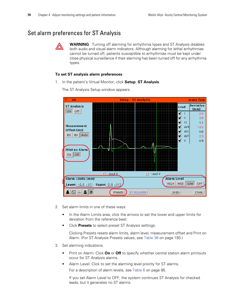 Set alarm preferences for st analysis | Welch Allyn Acuity and Mobile Acuity LT Central Monitoring Systems - User Manual User Manual | Page 78 / 214
