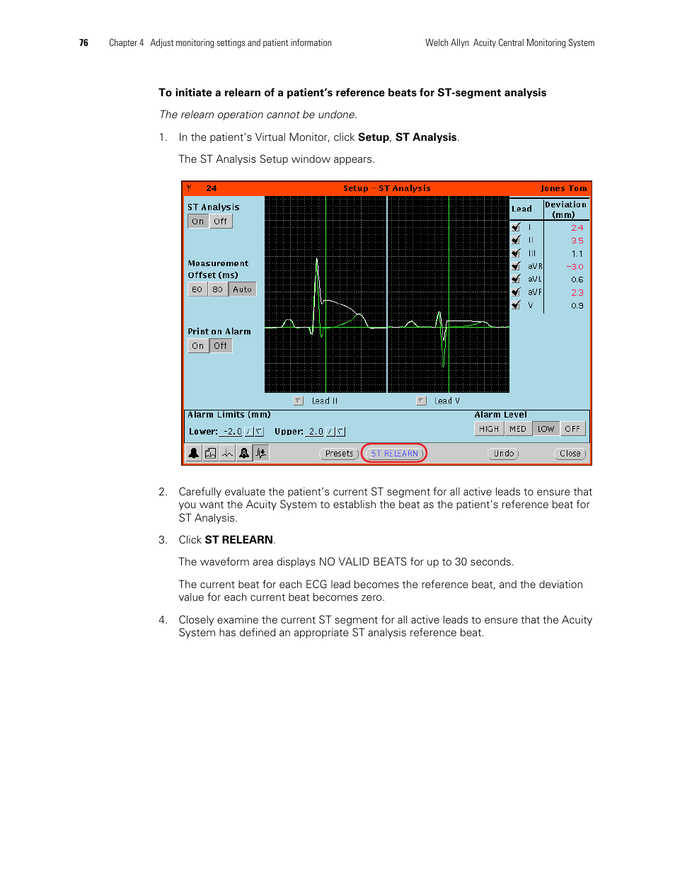 Welch Allyn Acuity and Mobile Acuity LT Central Monitoring Systems - User Manual User Manual | Page 80 / 214