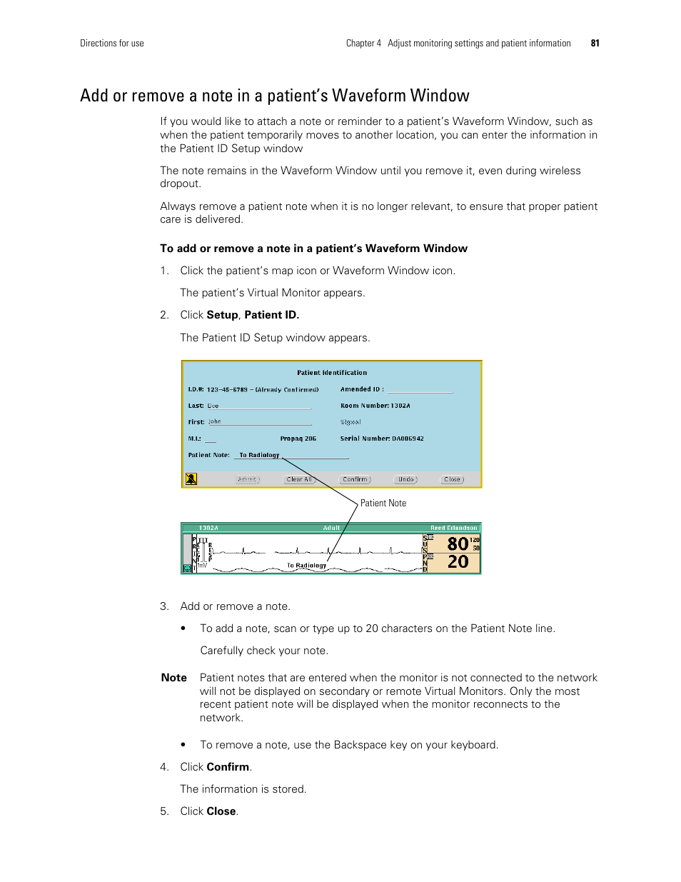 Add or remove a note in a patient’s, Waveform window | Welch Allyn Acuity and Mobile Acuity LT Central Monitoring Systems - User Manual User Manual | Page 85 / 214