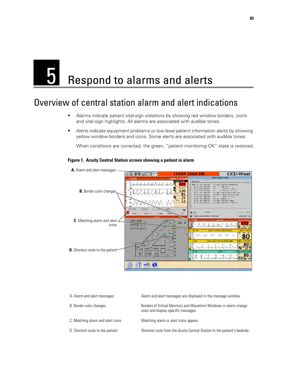 Respond to alarms and alerts, 5 - respond to alarms and alerts | Welch Allyn Acuity and Mobile Acuity LT Central Monitoring Systems - User Manual User Manual | Page 87 / 214