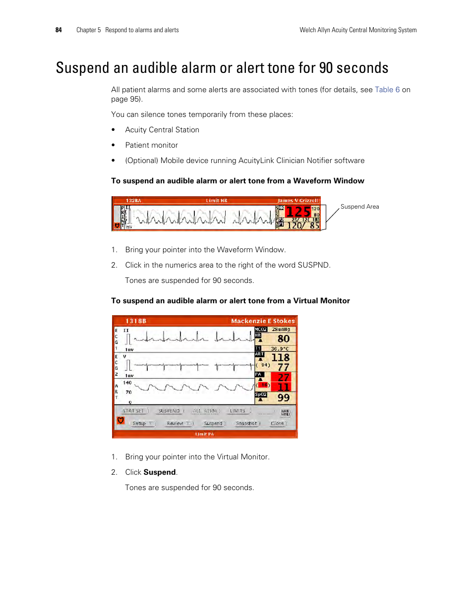 Welch Allyn Acuity and Mobile Acuity LT Central Monitoring Systems - User Manual User Manual | Page 88 / 214