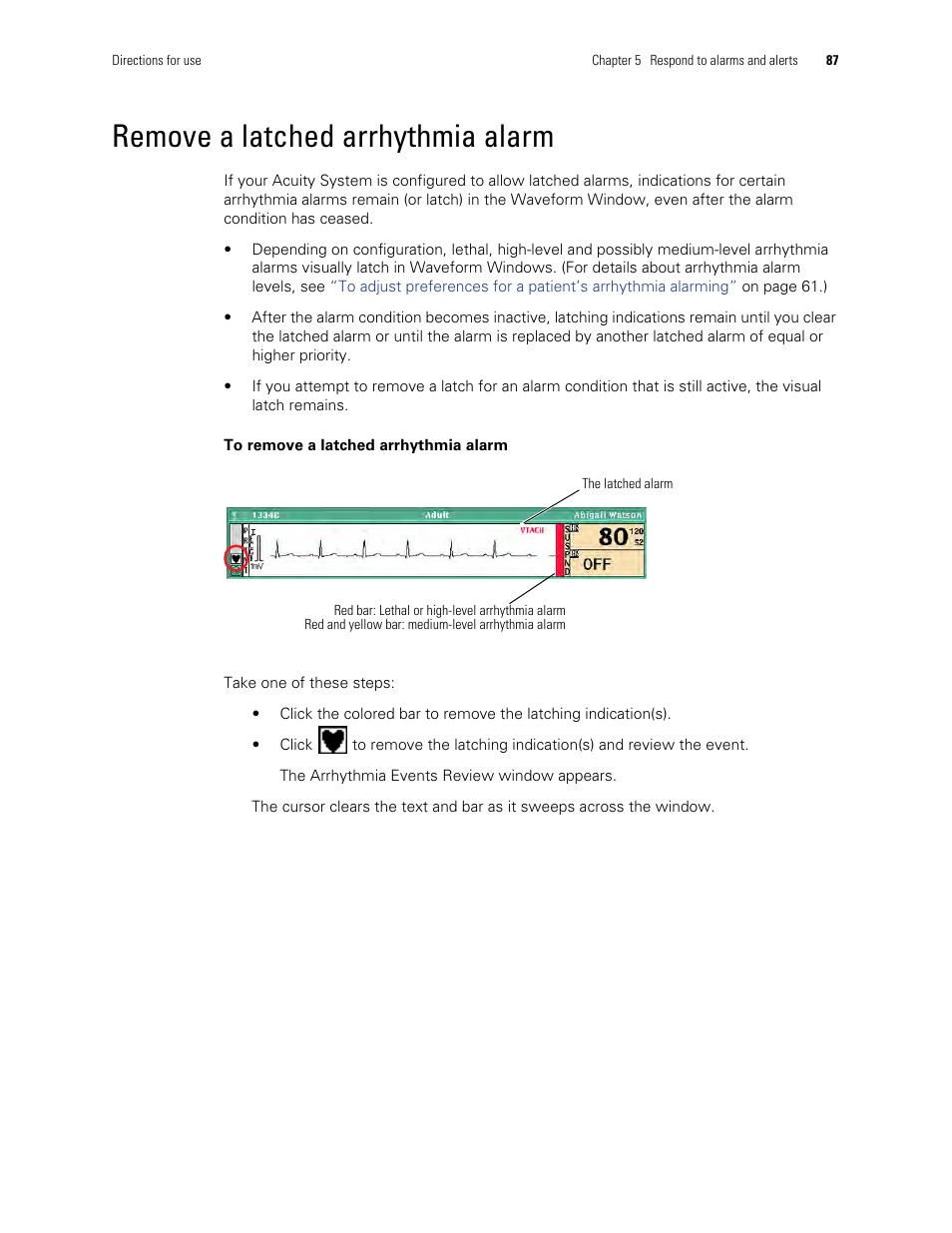 Remove a latched arrhythmia alarm | Welch Allyn Acuity and Mobile Acuity LT Central Monitoring Systems - User Manual User Manual | Page 91 / 214
