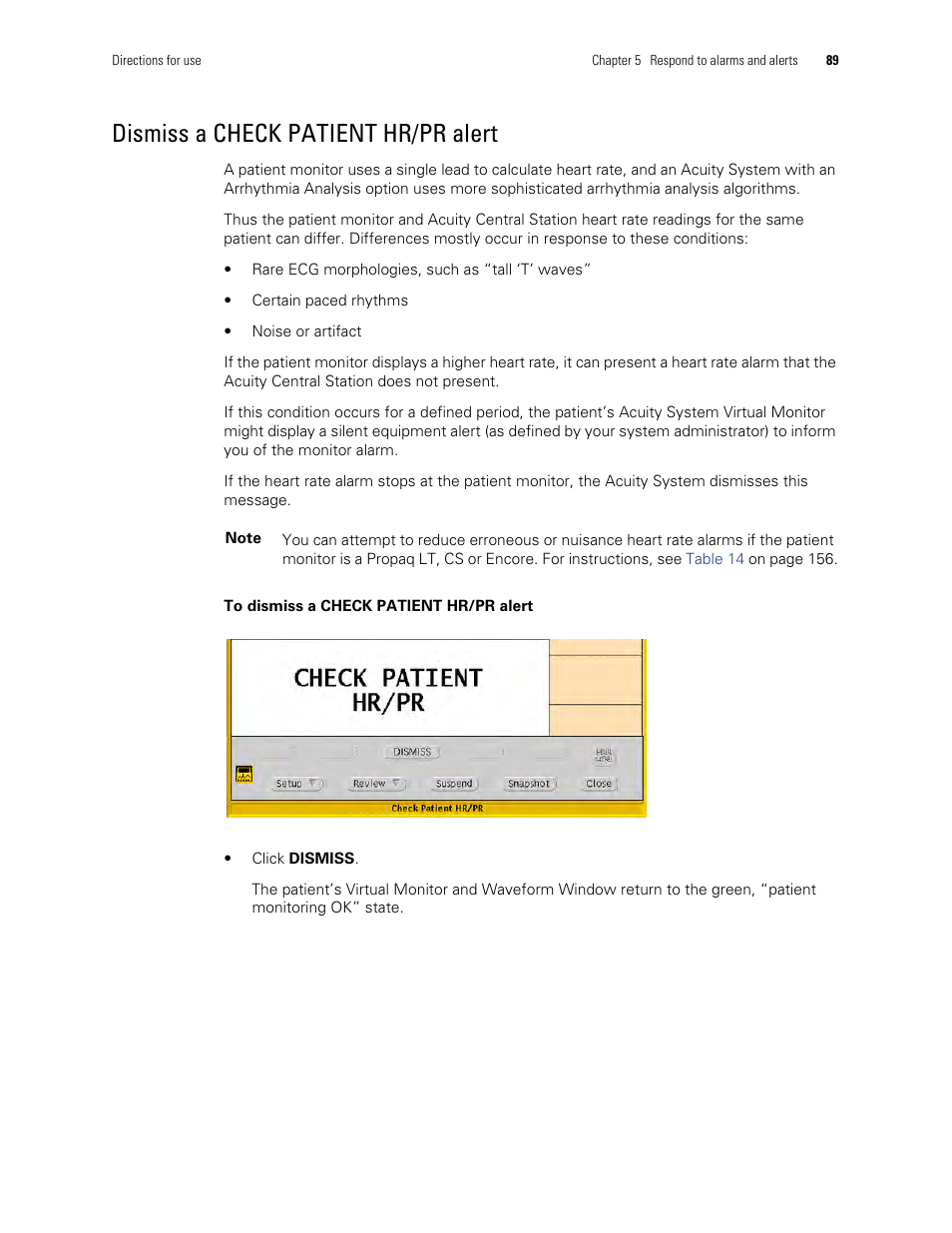 Dismiss a check patient hr/pr alert | Welch Allyn Acuity and Mobile Acuity LT Central Monitoring Systems - User Manual User Manual | Page 93 / 214