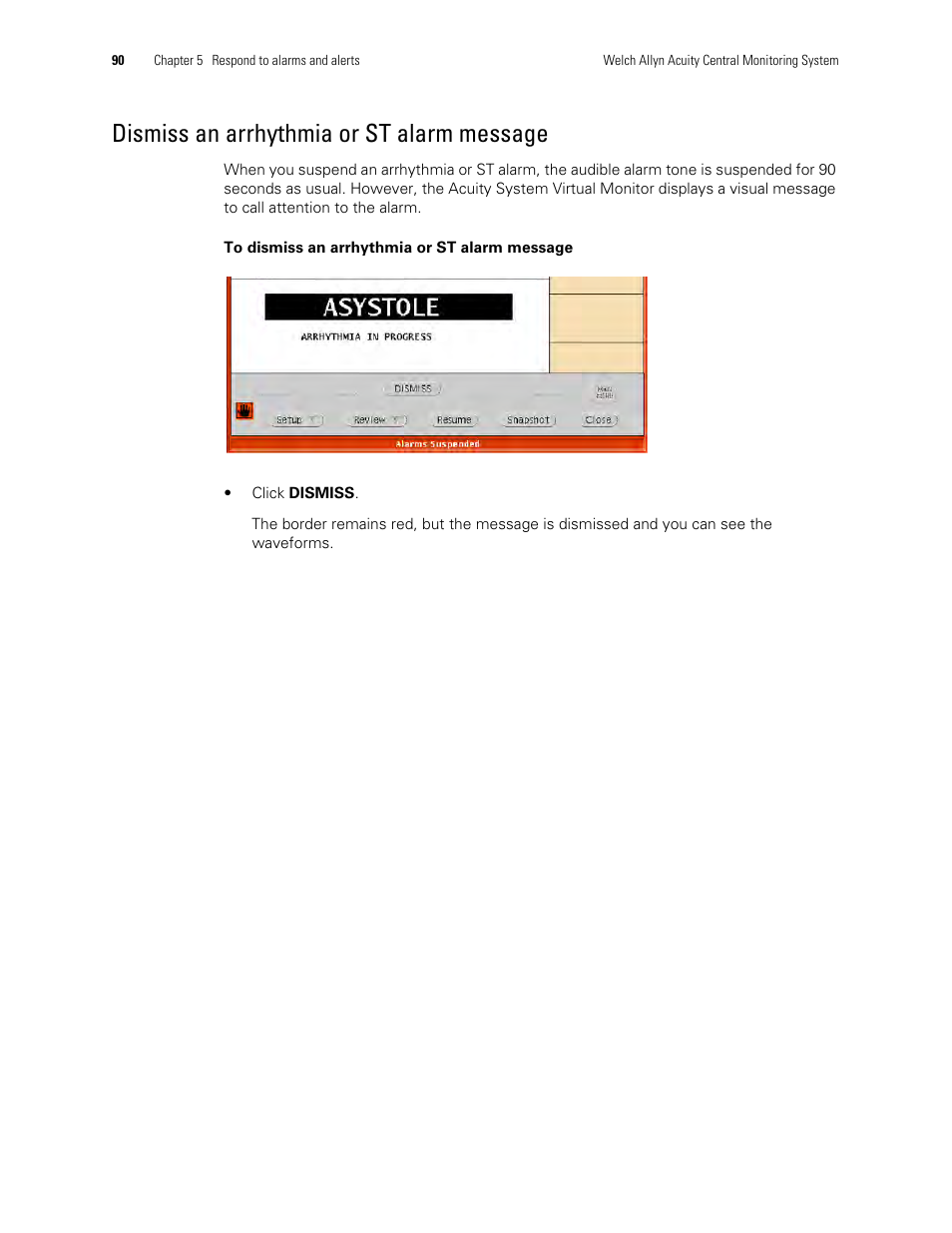Dismiss an arrhythmia or st alarm message | Welch Allyn Acuity and Mobile Acuity LT Central Monitoring Systems - User Manual User Manual | Page 94 / 214
