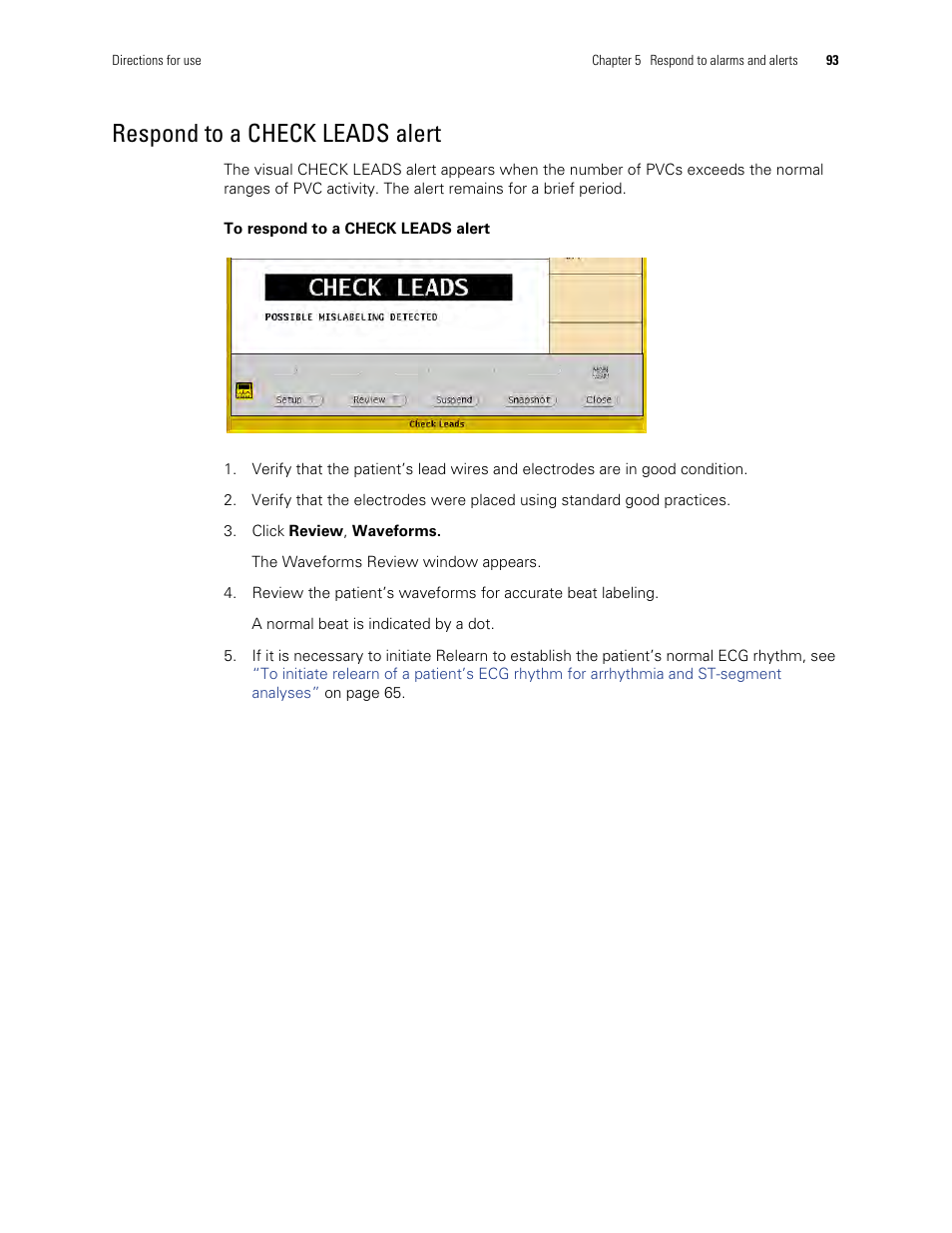 Respond to a check leads alert | Welch Allyn Acuity and Mobile Acuity LT Central Monitoring Systems - User Manual User Manual | Page 97 / 214