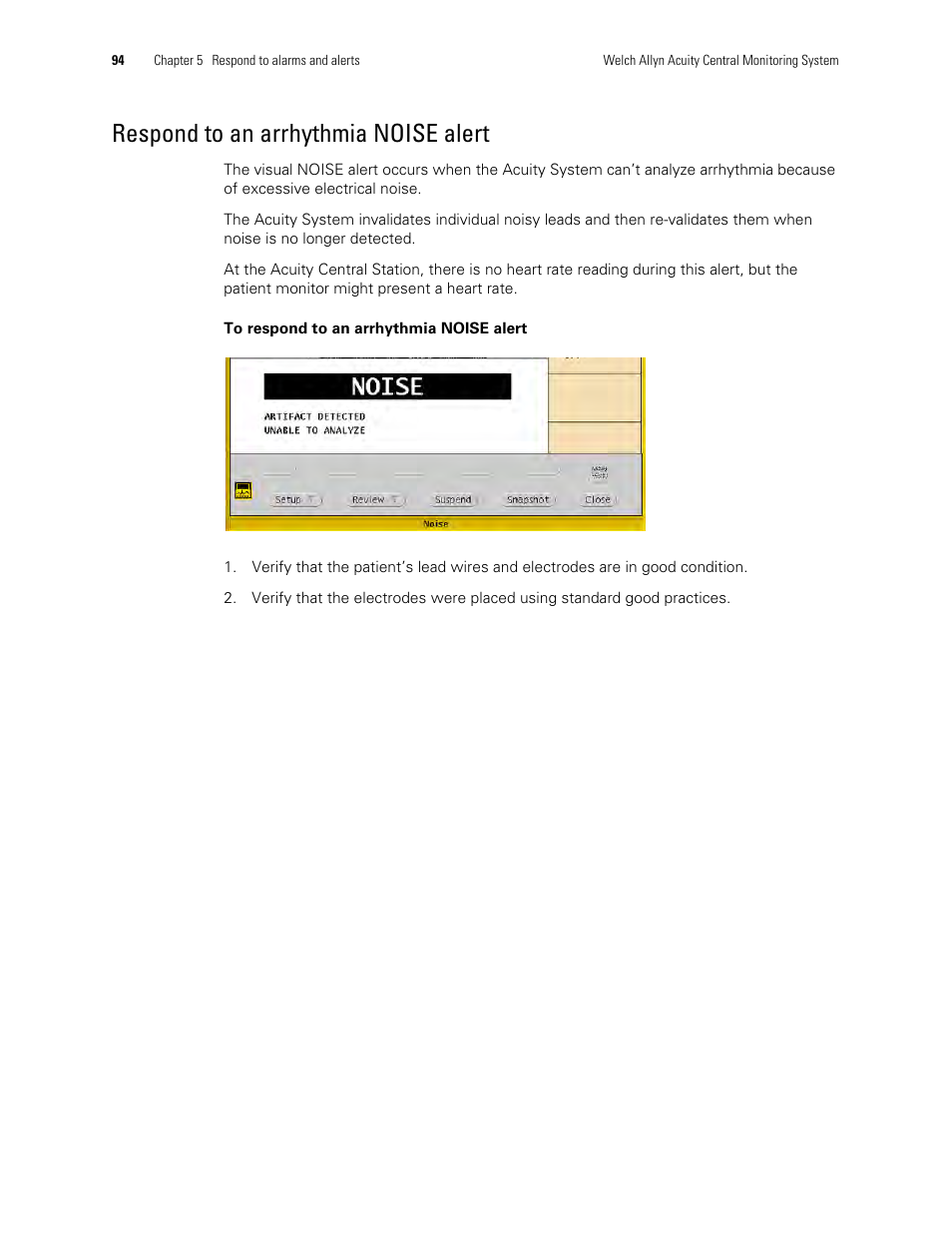 Respond to an arrhythmia noise alert | Welch Allyn Acuity and Mobile Acuity LT Central Monitoring Systems - User Manual User Manual | Page 98 / 214