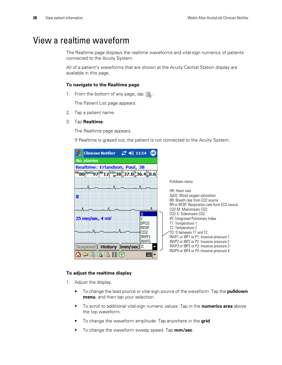 View a realtime waveform | Welch Allyn AcuityLink Clinician Notifier - User Manual User Manual | Page 32 / 64