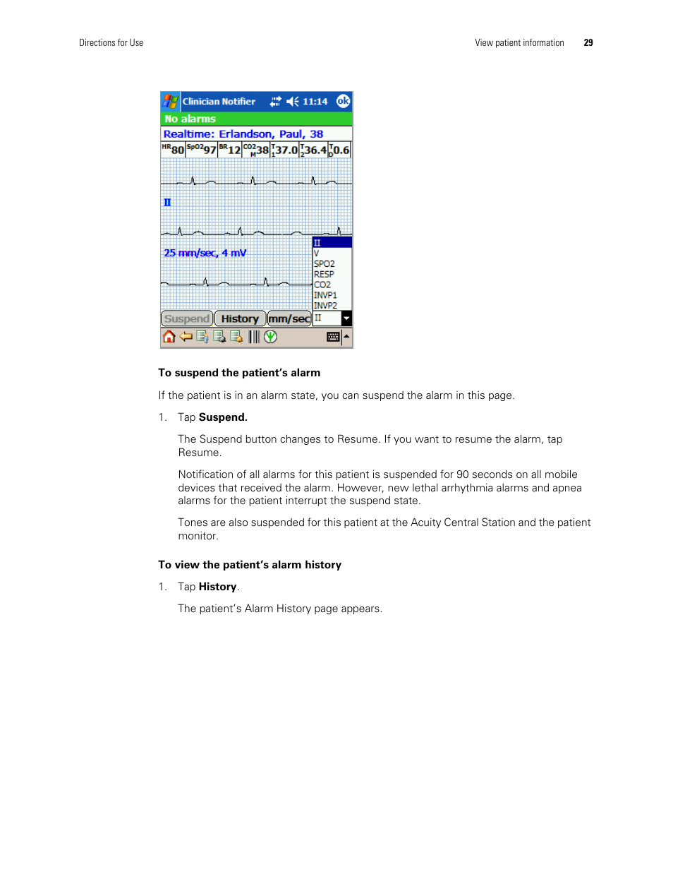 Welch Allyn AcuityLink Clinician Notifier - User Manual User Manual | Page 33 / 64