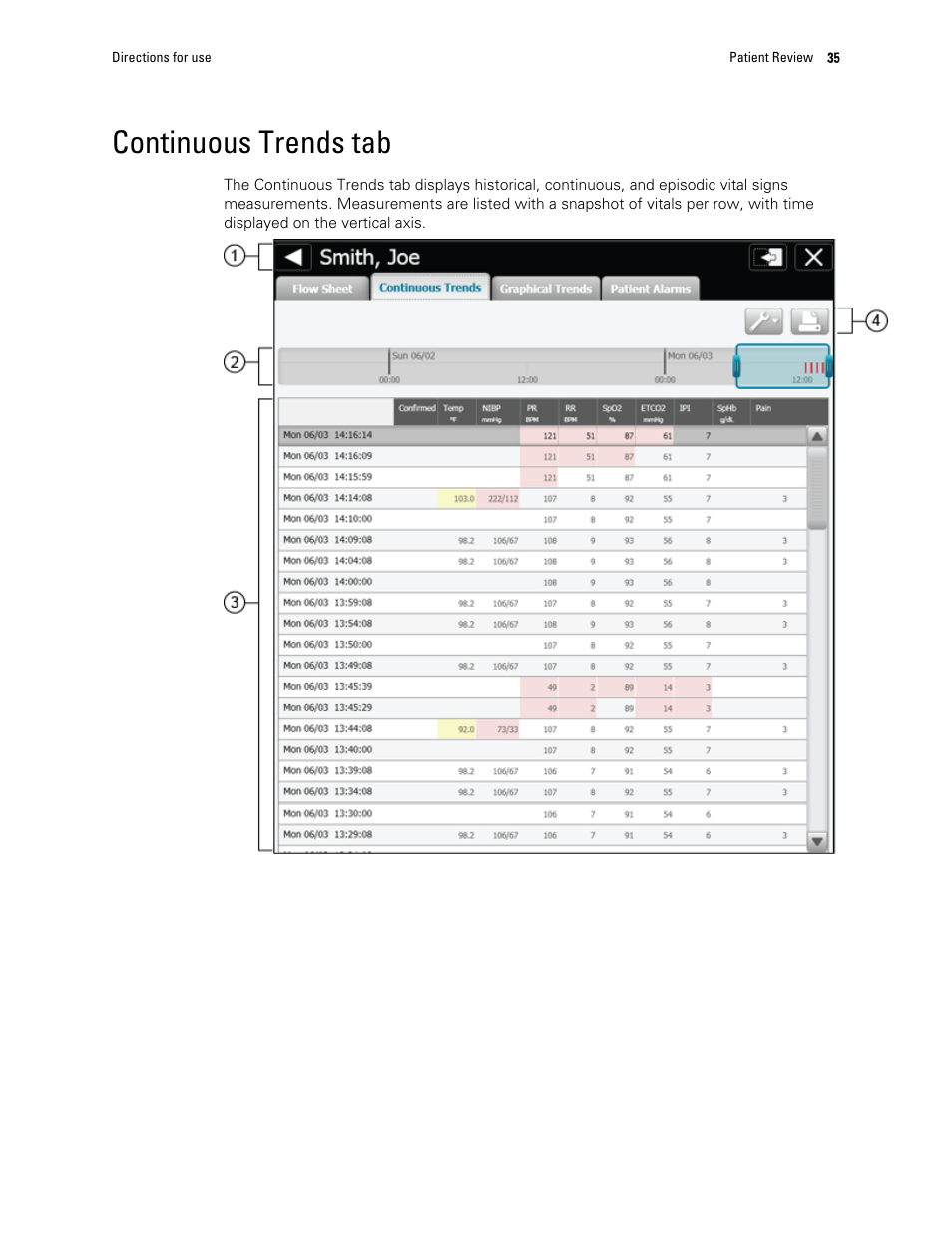 Continuous trends tab | Welch Allyn Connex Central Station - User Manual User Manual | Page 41 / 98