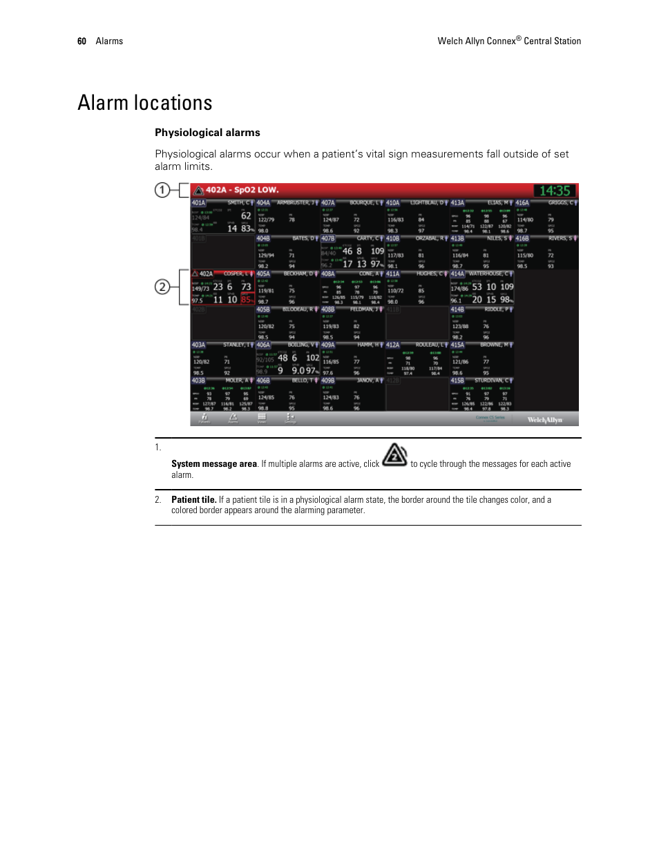 Alarm locations | Welch Allyn Connex Central Station - User Manual User Manual | Page 66 / 98