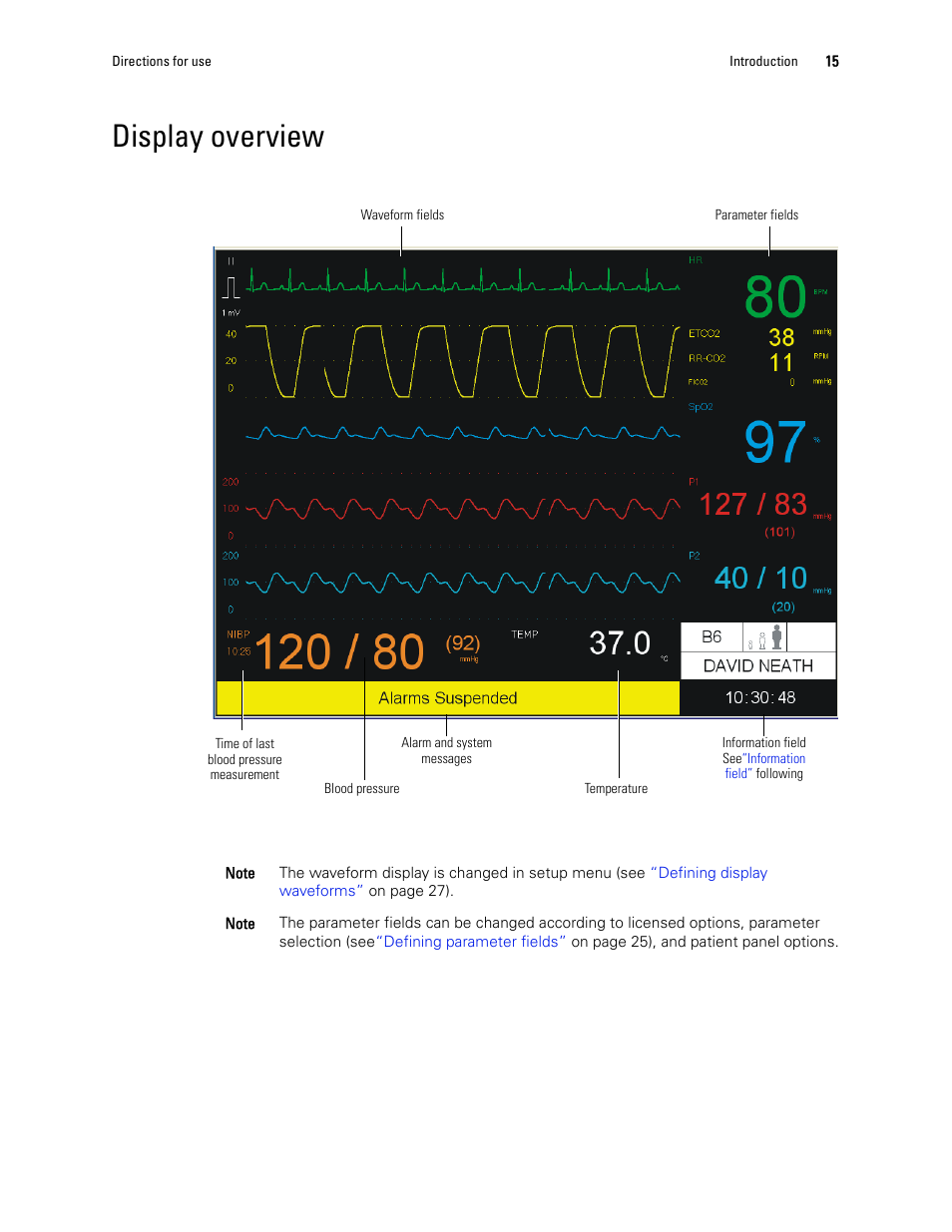 Display overview | Welch Allyn 1500 Patient Monitor v.1.4.X - User Manual User Manual | Page 19 / 144