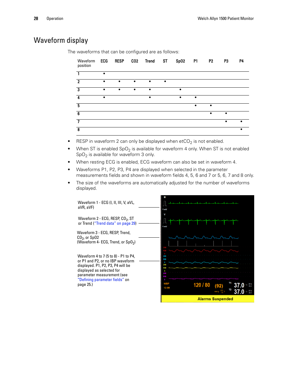 Waveform display | Welch Allyn 1500 Patient Monitor v.1.4.X - User Manual User Manual | Page 32 / 144