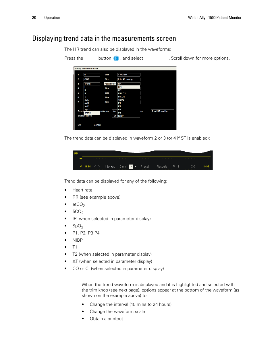 Displaying trend data in the measurements screen | Welch Allyn 1500 Patient Monitor v.1.4.X - User Manual User Manual | Page 34 / 144