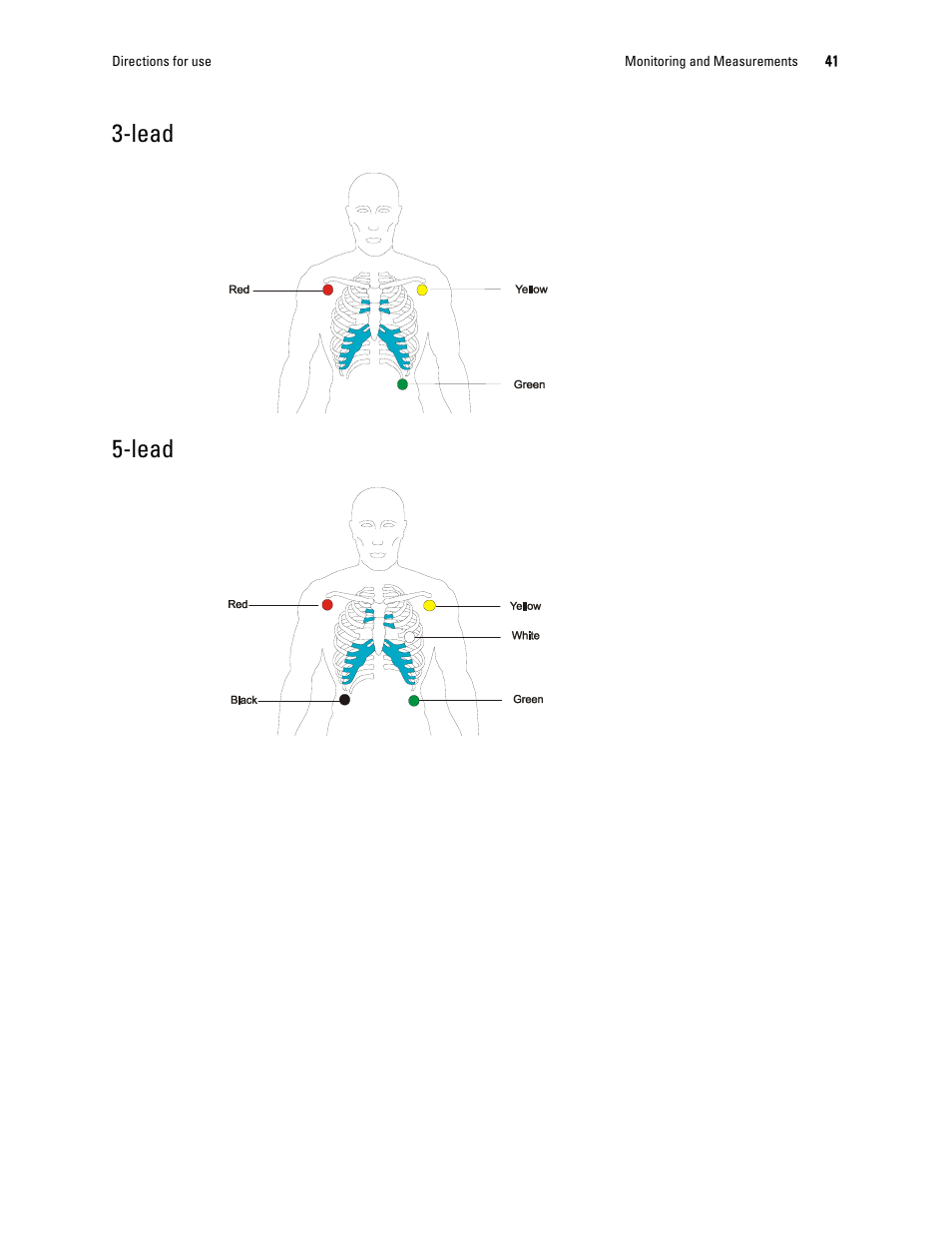Lead, Lead 5-lead | Welch Allyn 1500 Patient Monitor v.1.4.X - User Manual User Manual | Page 45 / 144