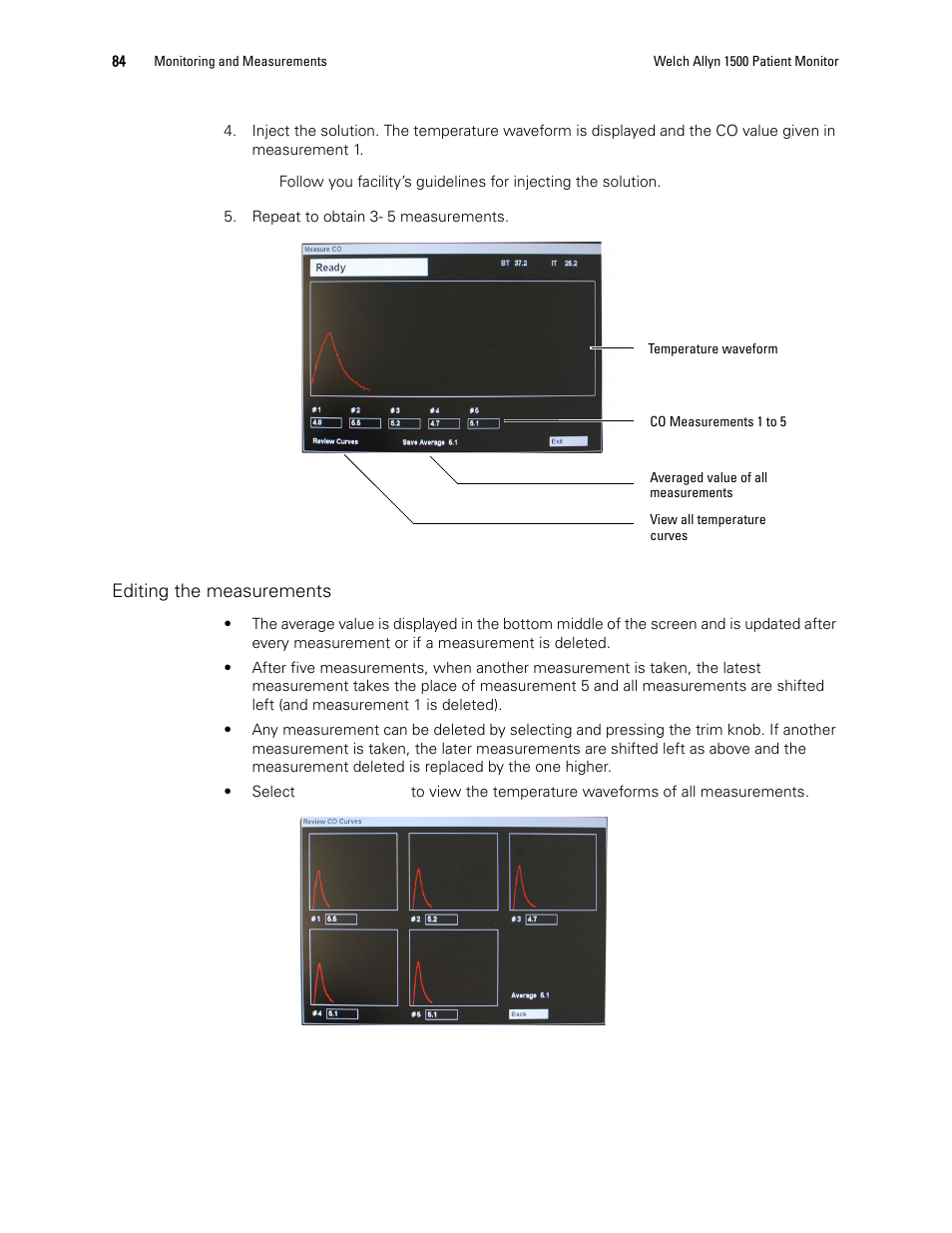 Welch Allyn 1500 Patient Monitor v.1.4.X - User Manual User Manual | Page 88 / 144
