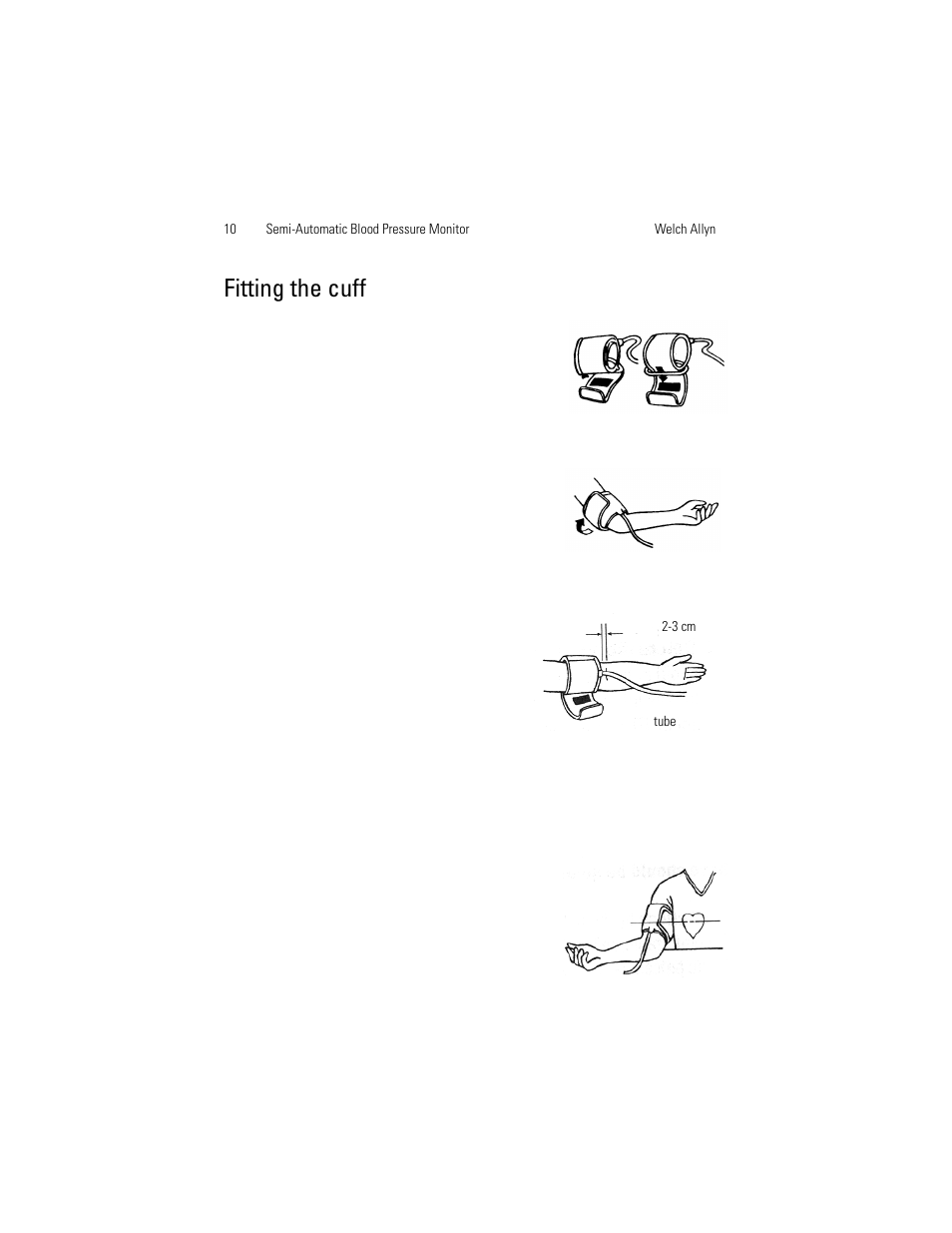 Fitting the cuff | Welch Allyn OSZ 4 - User Manual User Manual | Page 18 / 130