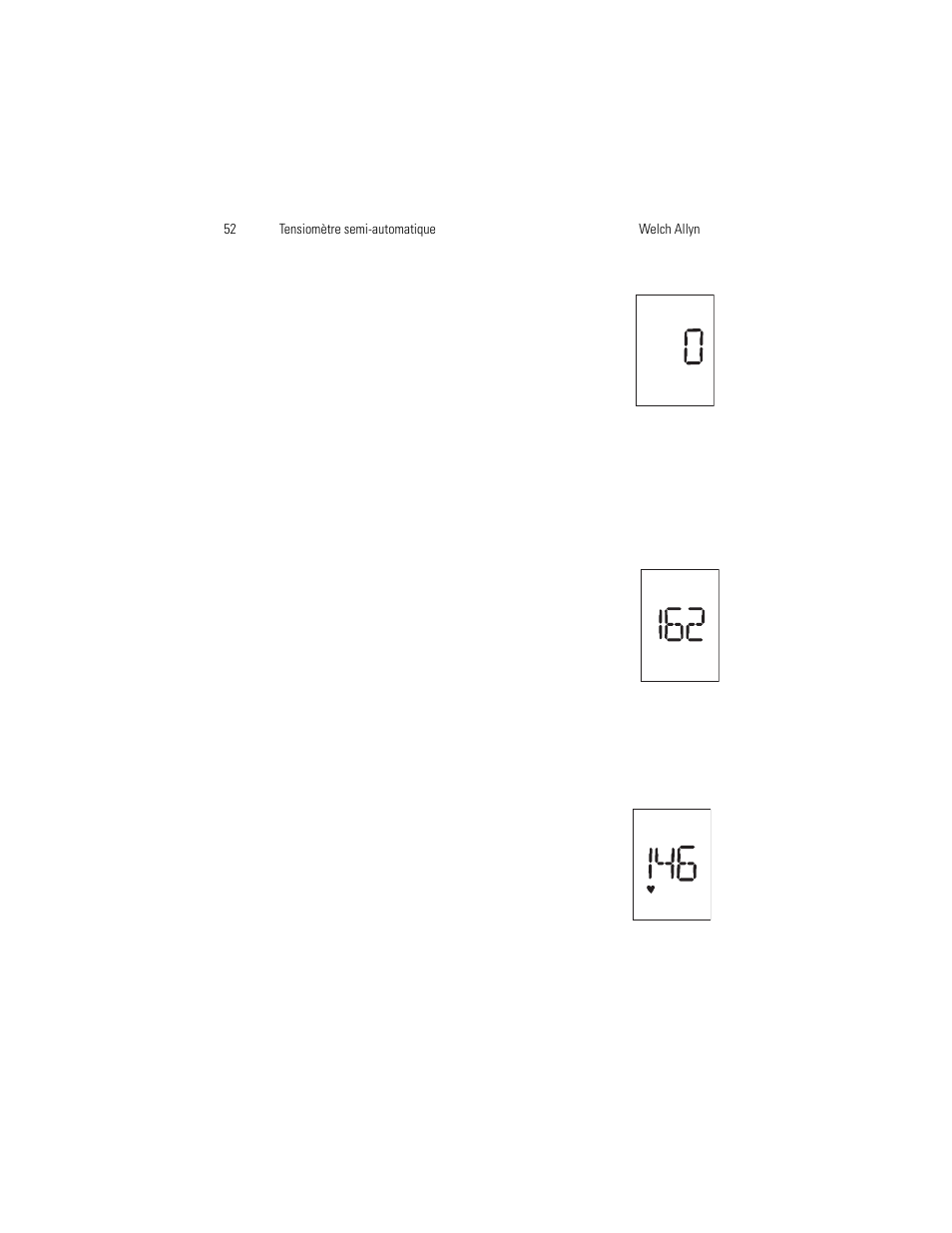Welch Allyn OSZ 4 - User Manual User Manual | Page 60 / 130