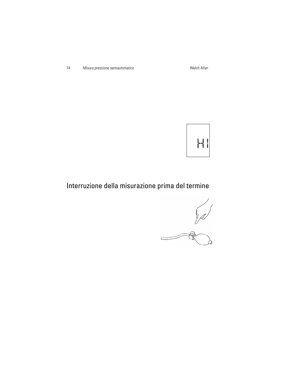 Interruzione della misurazione prima del termine | Welch Allyn OSZ 4 - User Manual User Manual | Page 82 / 130