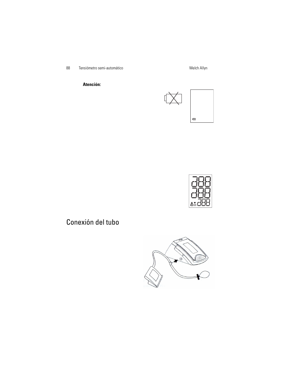 Conexión del tubo | Welch Allyn OSZ 4 - User Manual User Manual | Page 96 / 130