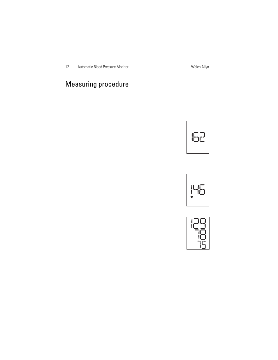 Measuring procedure | Welch Allyn OSZ 5 - User Manual User Manual | Page 20 / 124