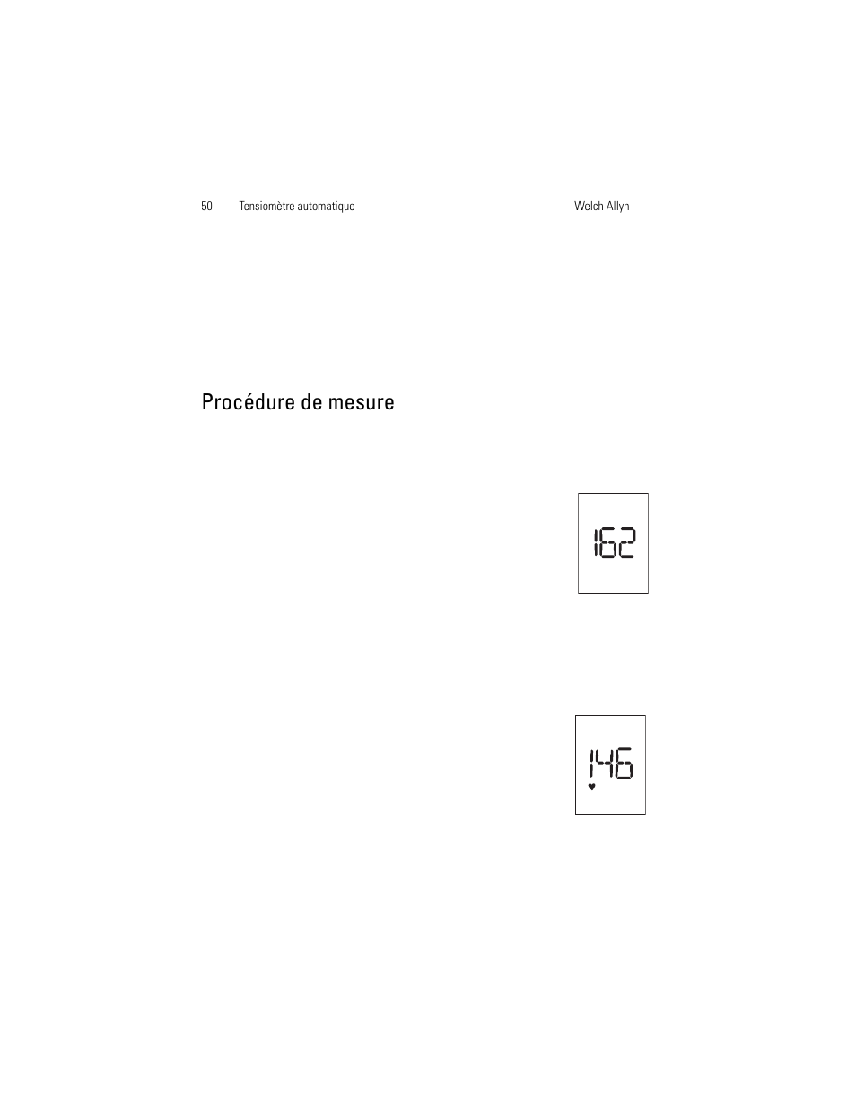Procédure de mesure | Welch Allyn OSZ 5 - User Manual User Manual | Page 58 / 124