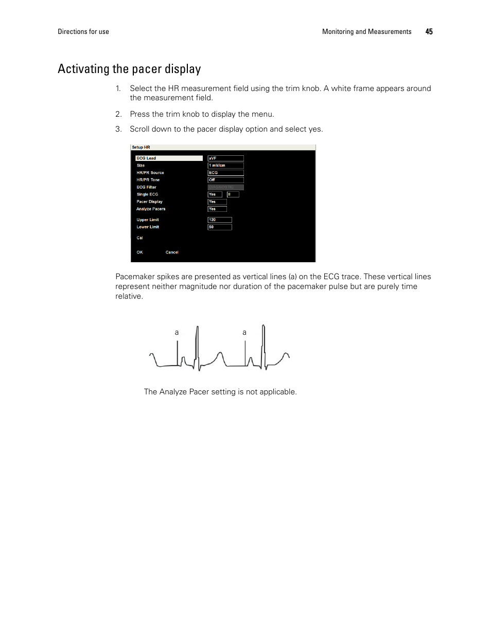 Activating the pacer display | Welch Allyn 1500 Patient Monitor v.1.3.X - User Manual User Manual | Page 49 / 134