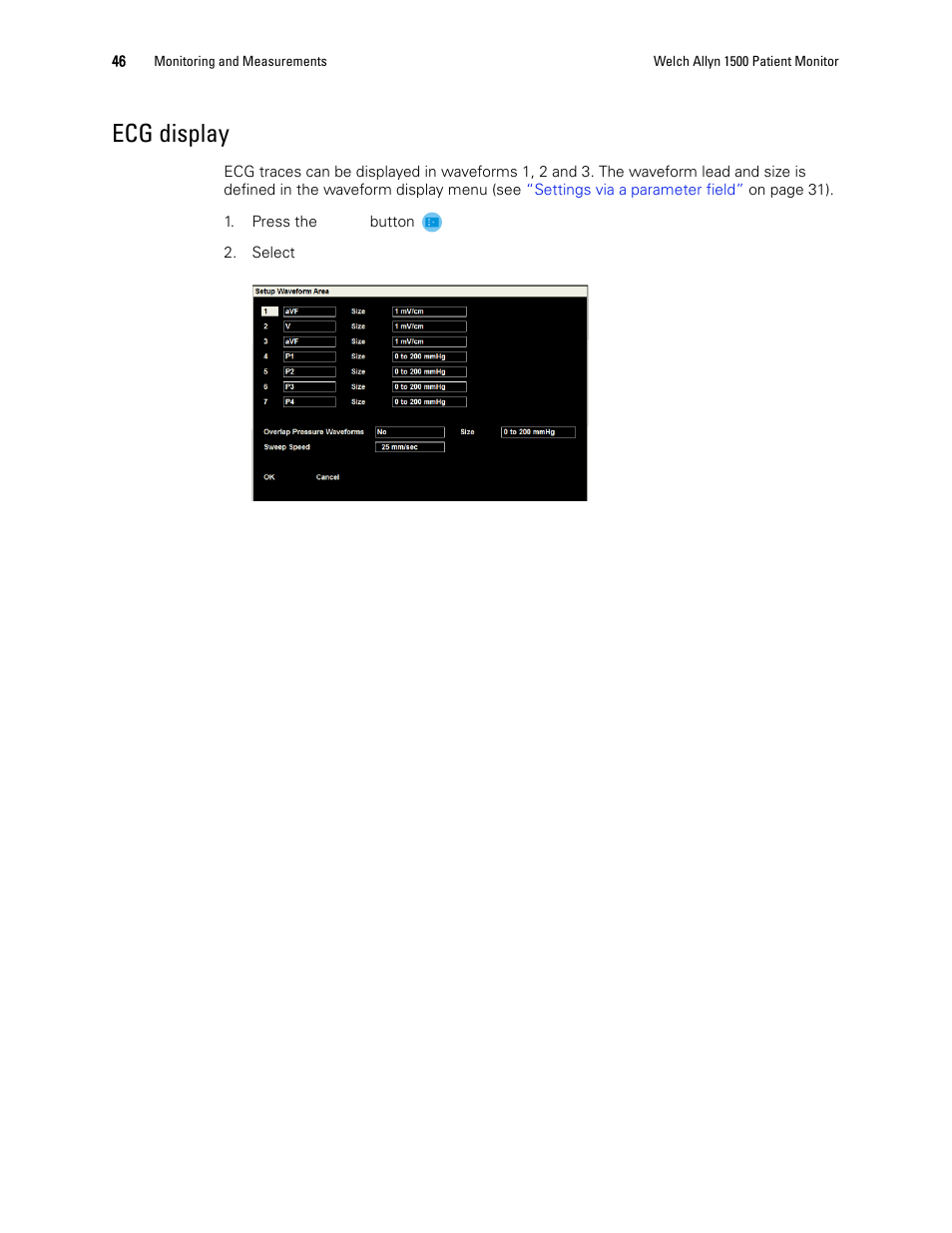 Ecg display | Welch Allyn 1500 Patient Monitor v.1.3.X - User Manual User Manual | Page 50 / 134