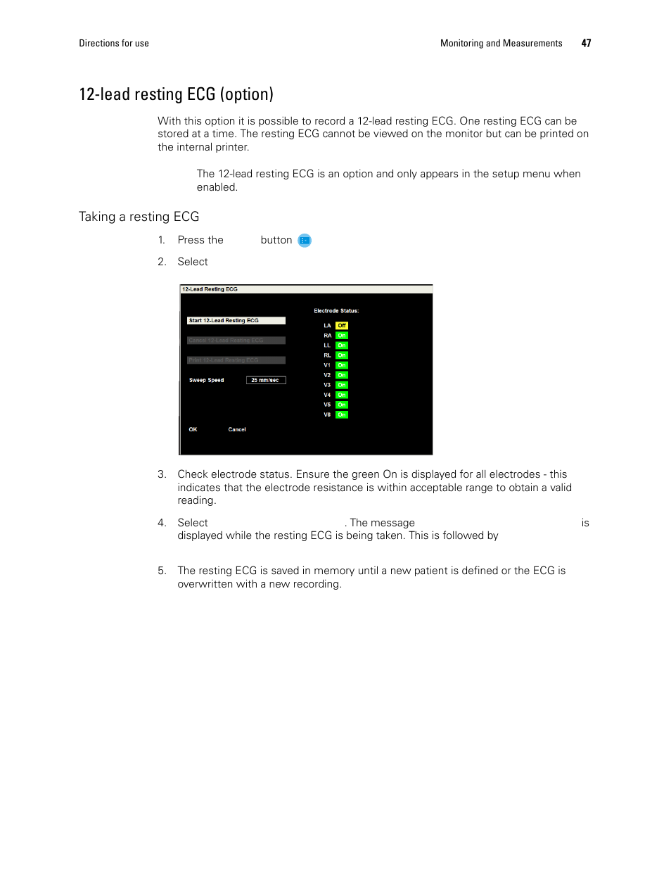 Lead resting ecg (option) | Welch Allyn 1500 Patient Monitor v.1.3.X - User Manual User Manual | Page 51 / 134