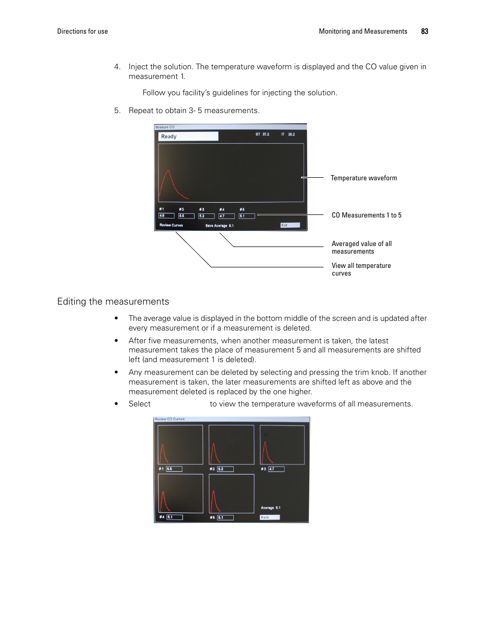 Welch Allyn 1500 Patient Monitor v.1.3.X - User Manual User Manual | Page 87 / 134
