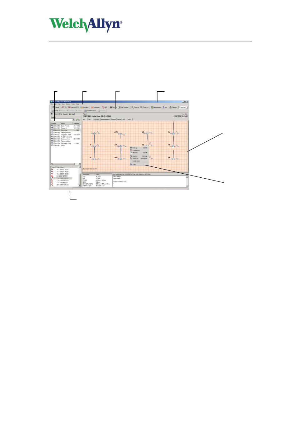 Cardioperfect workstation, User manual | Welch Allyn CardioPerfect Workstation - User Manual User Manual | Page 10 / 38