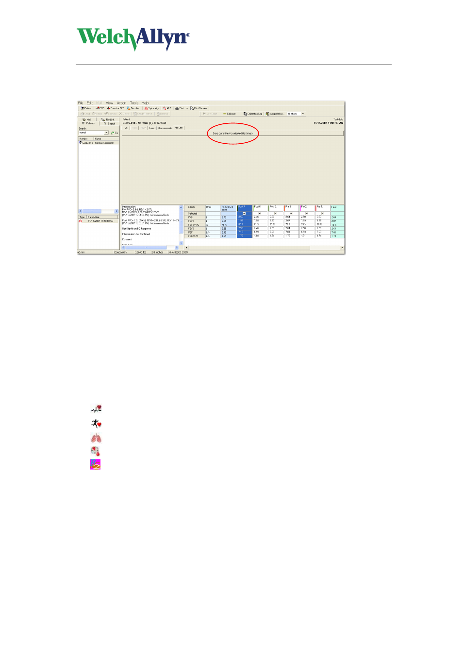 3 customizing .txt files, To customize the statements, To open a file in notepad | Cardioperfect workstation, User manual | Welch Allyn CardioPerfect Workstation - User Manual User Manual | Page 31 / 38