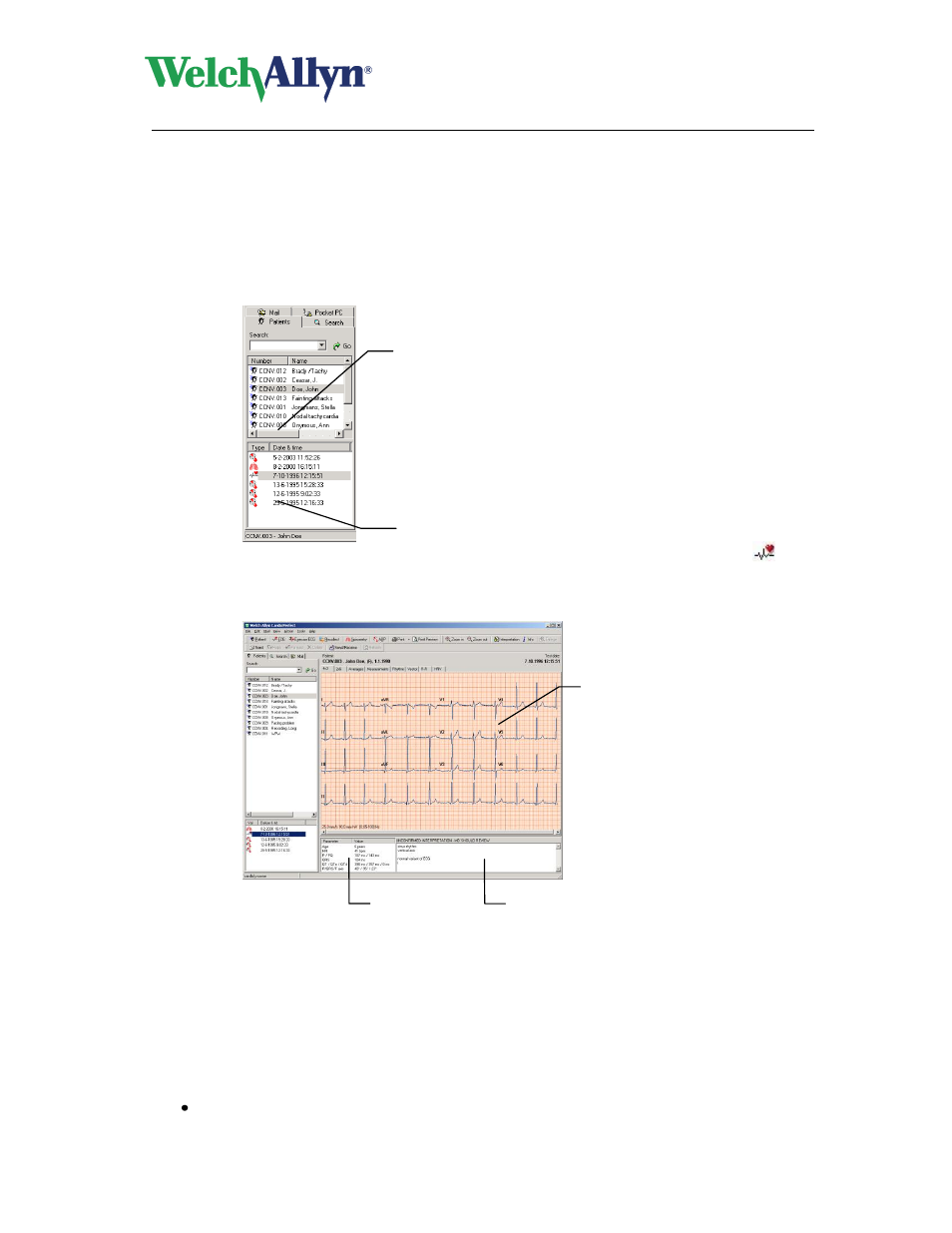 Viewing ecgs, To view an ecg, View and edit ecg information | To view ecg information, Cardioperfect workstation, Resting ecg module - user manual | Welch Allyn CardioPerfect Workstation Resting ECG Module - User Manual User Manual | Page 20 / 54