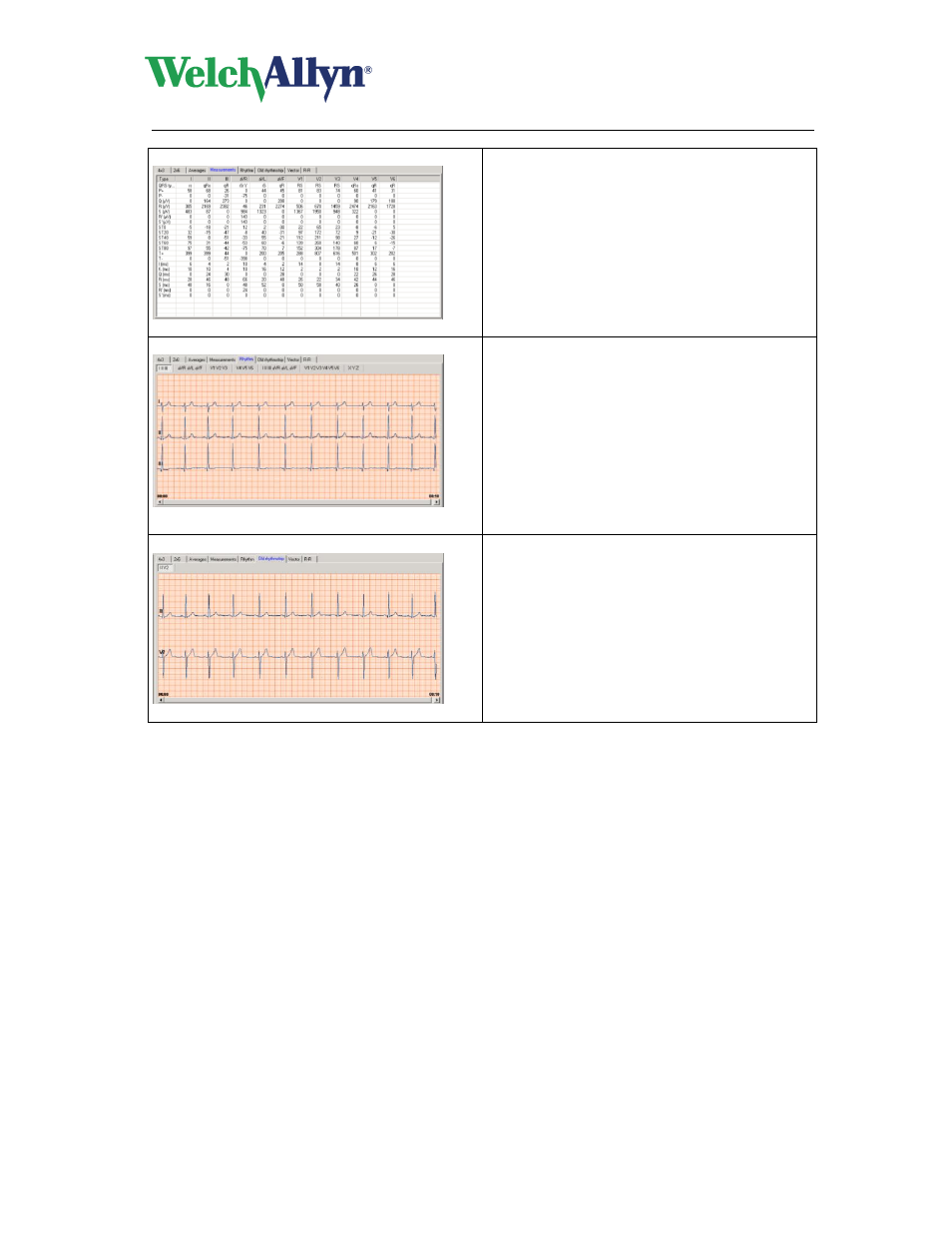 Cardioperfect workstation, Resting ecg module - user manual | Welch Allyn CardioPerfect Workstation Resting ECG Module - User Manual User Manual | Page 22 / 54