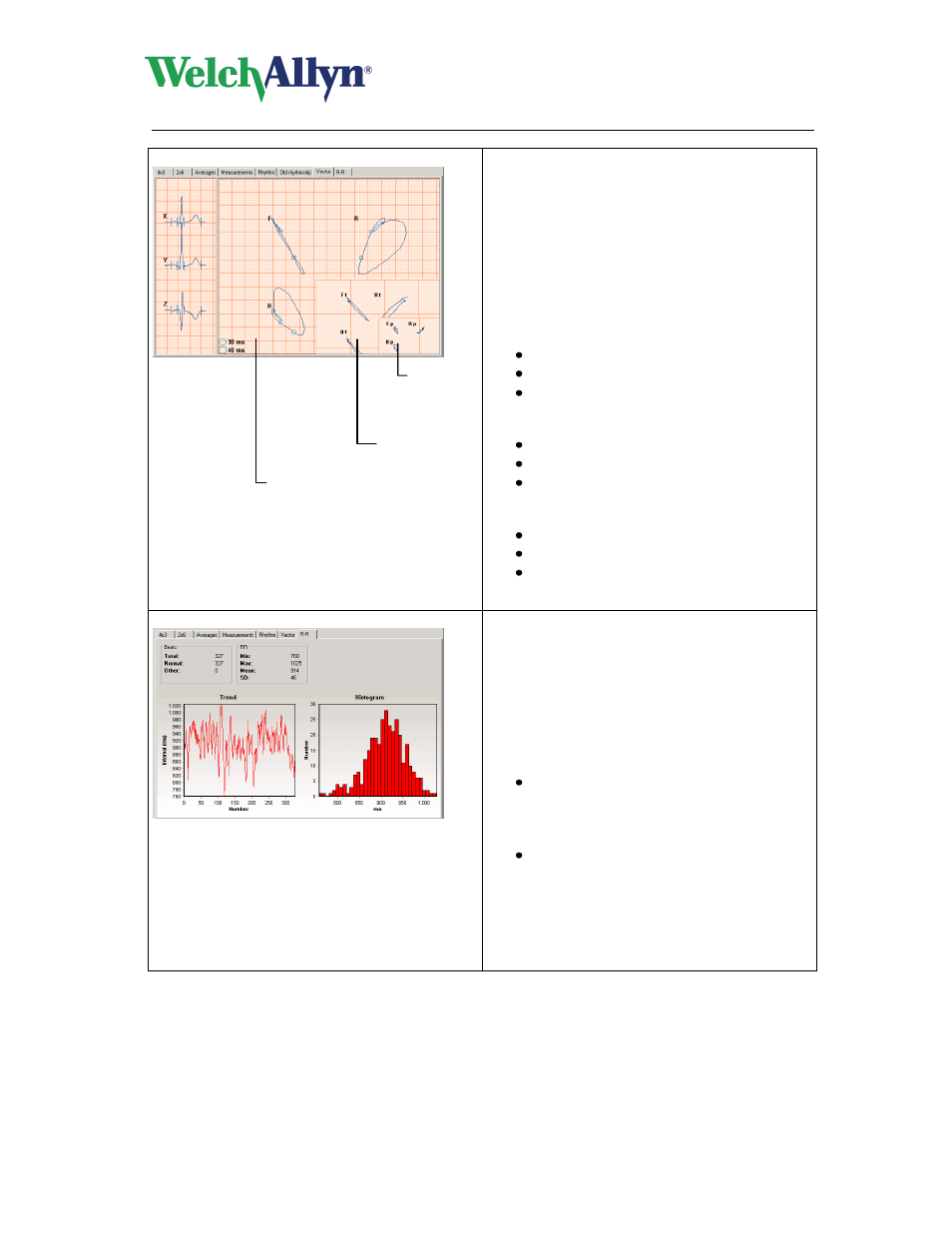 Cardioperfect workstation, Resting ecg module - user manual | Welch Allyn CardioPerfect Workstation Resting ECG Module - User Manual User Manual | Page 23 / 54