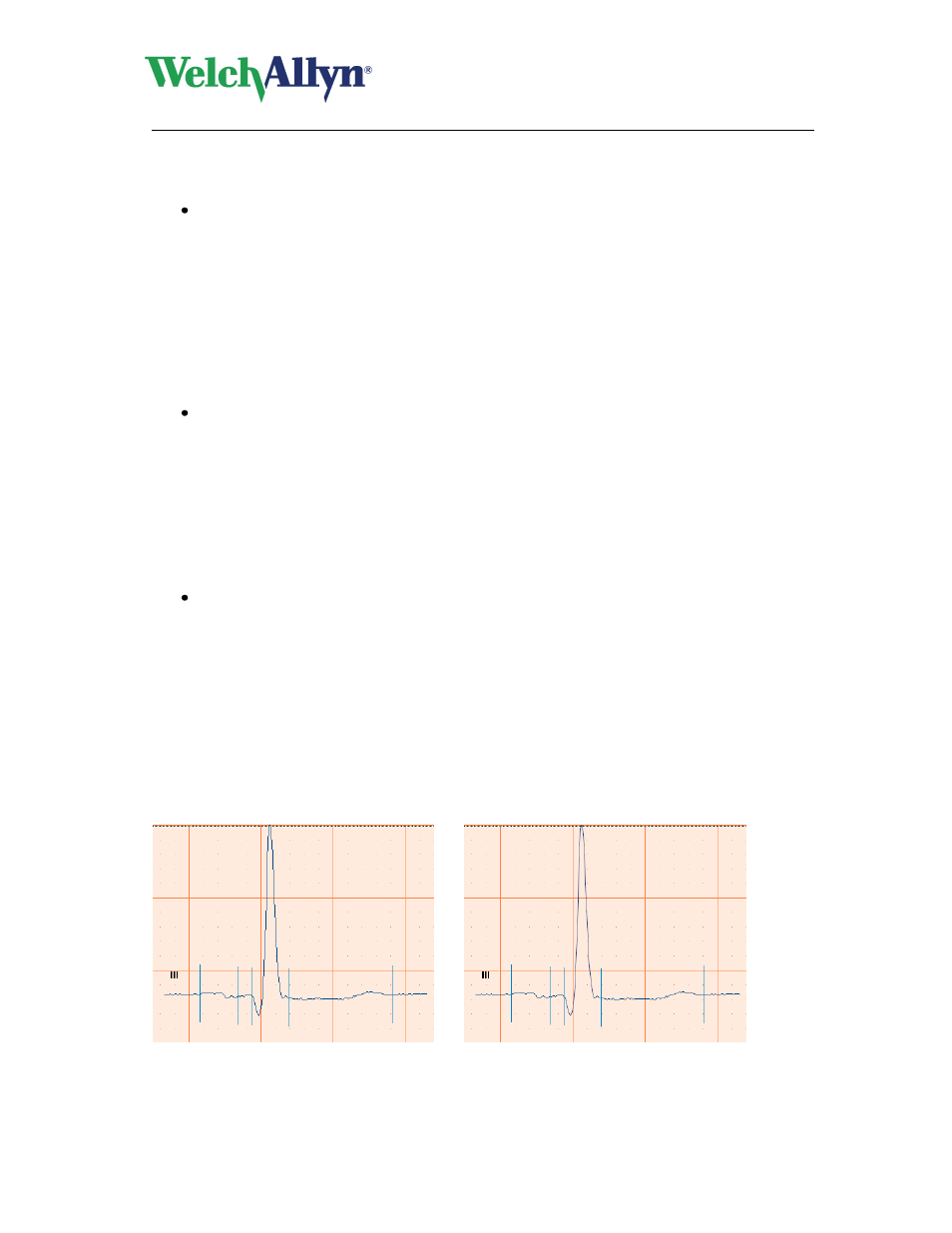 To apply a muscle noise filter, Apply ac filter, Apply baseline filter | Apply anti-aliasing, Cardioperfect workstation, Resting ecg module - user manual | Welch Allyn CardioPerfect Workstation Resting ECG Module - User Manual User Manual | Page 28 / 54
