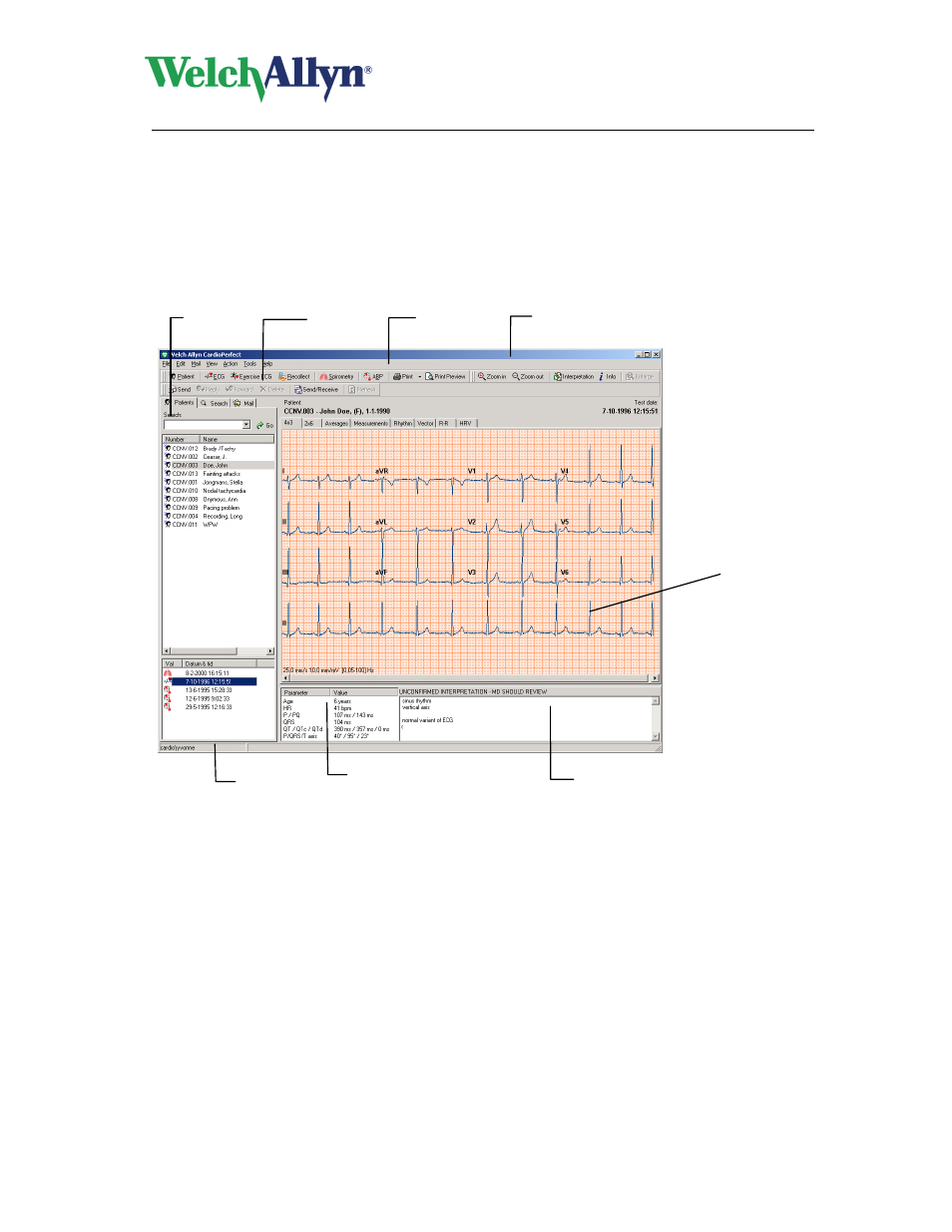 Getting started, The welch allyn cardioperfect resting ecg window, Cardioperfect workstation | Resting ecg module - user manual | Welch Allyn CardioPerfect Workstation Resting ECG Module - User Manual User Manual | Page 8 / 54
