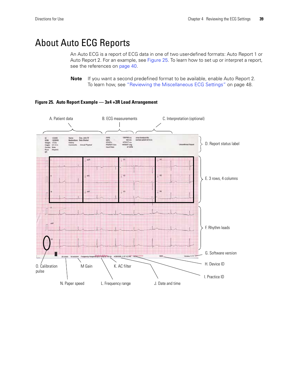 About auto ecg reports | Welch Allyn CP 200 12-Lead Resting Electrocardiograph - User Manual User Manual | Page 43 / 112