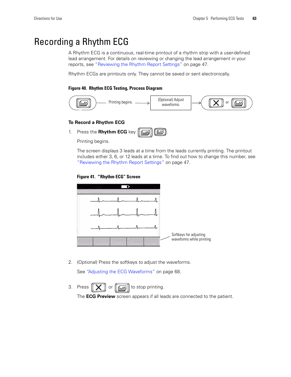 Recording a rhythm ecg, Step 2 | Welch Allyn CP 200 12-Lead Resting Electrocardiograph - User Manual User Manual | Page 67 / 112