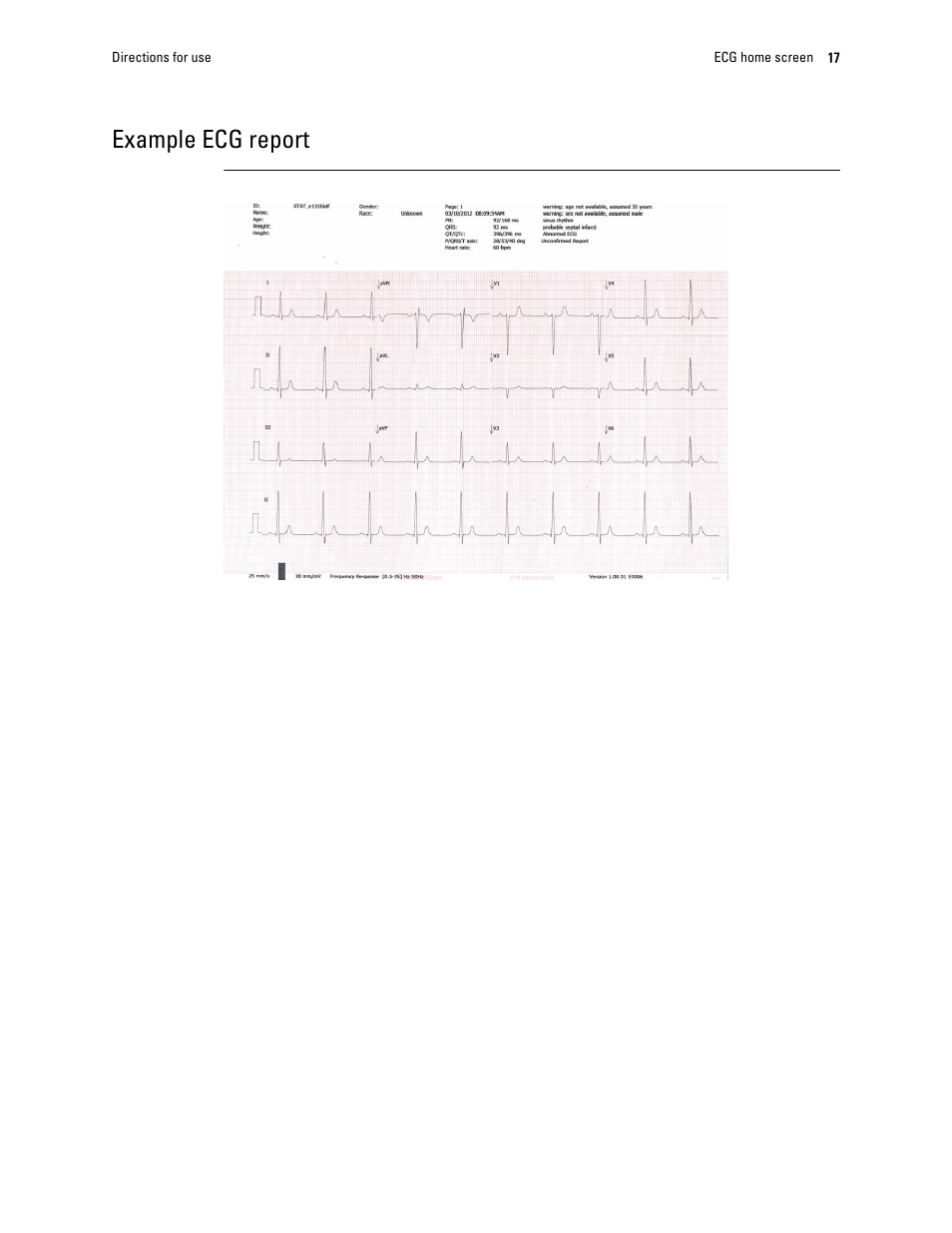 Example ecg report | Welch Allyn CP 150 12-lead resting electrocardiograph v.1.00.XX - User Manual User Manual | Page 21 / 58