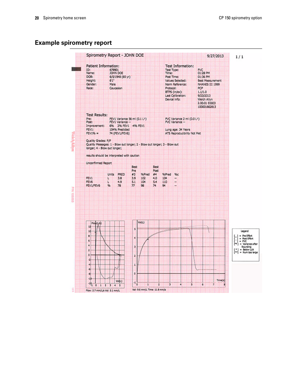 Example spirometry report | Welch Allyn CP 150 spirometry option - User Manual User Manual | Page 24 / 68