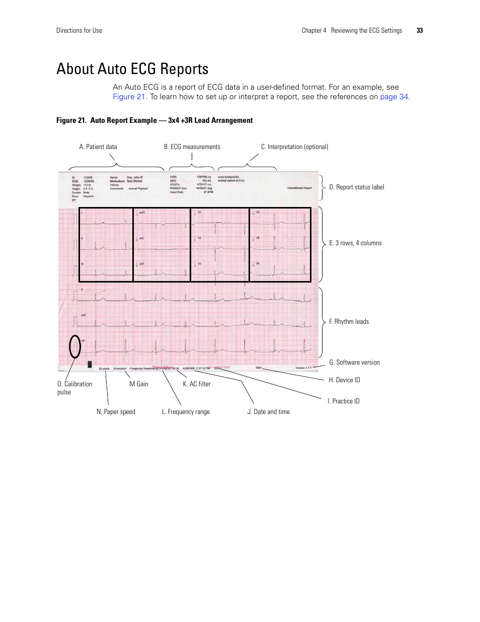 About auto ecg reports | Welch Allyn CP 100 12-Lead Resting Electrocardiograph - User Manual User Manual | Page 37 / 90