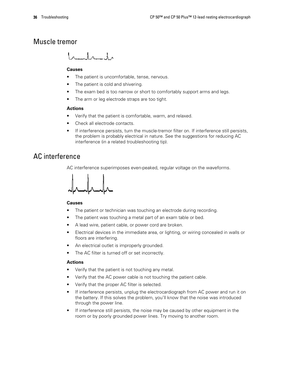 Muscle tremor, Ac interference | Welch Allyn CP 50 Plus 12-lead resting electrocardiograph - User Manual User Manual | Page 40 / 52